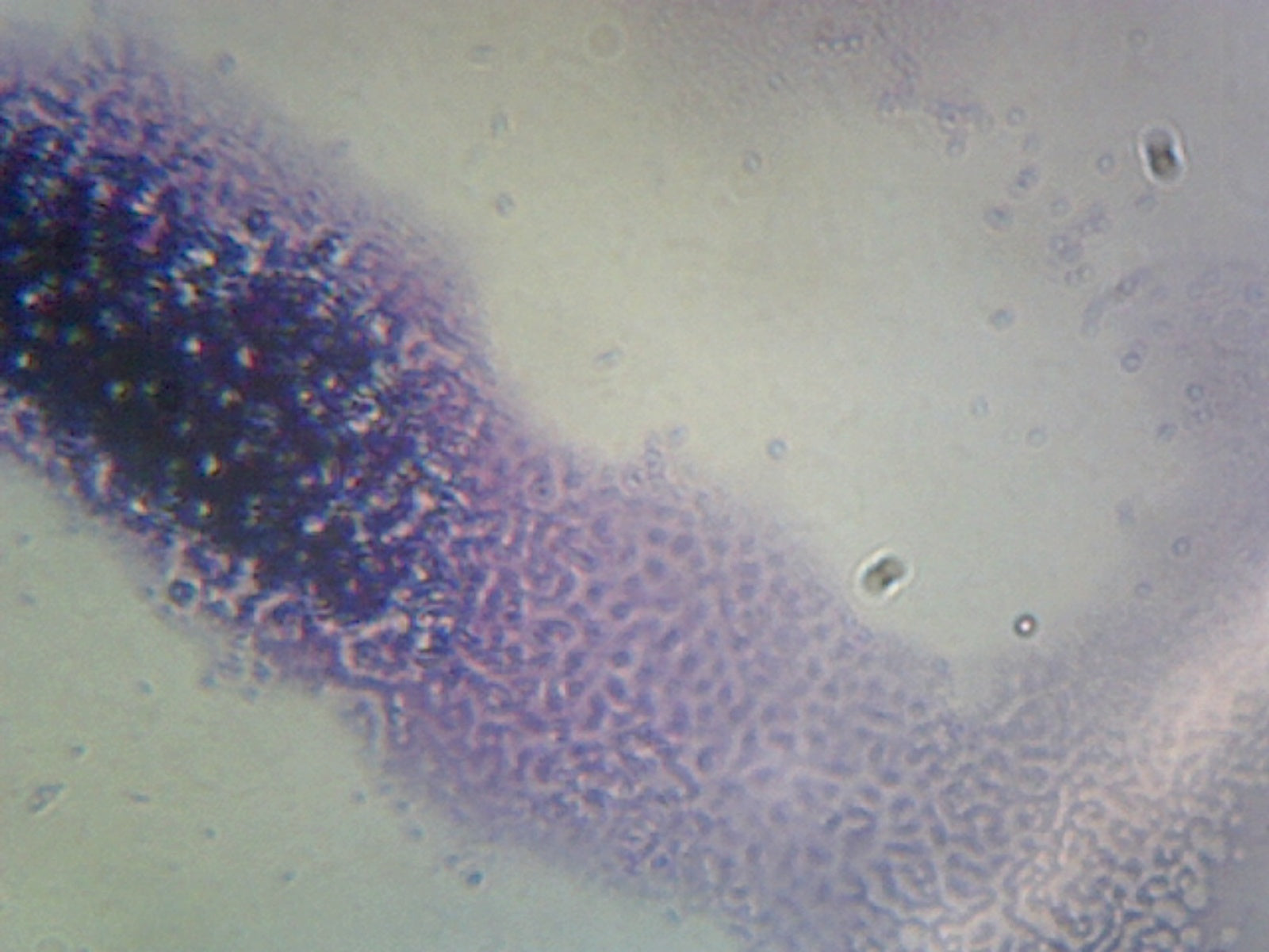 Shigella Dysenteriae; Smear; Gram-Negative