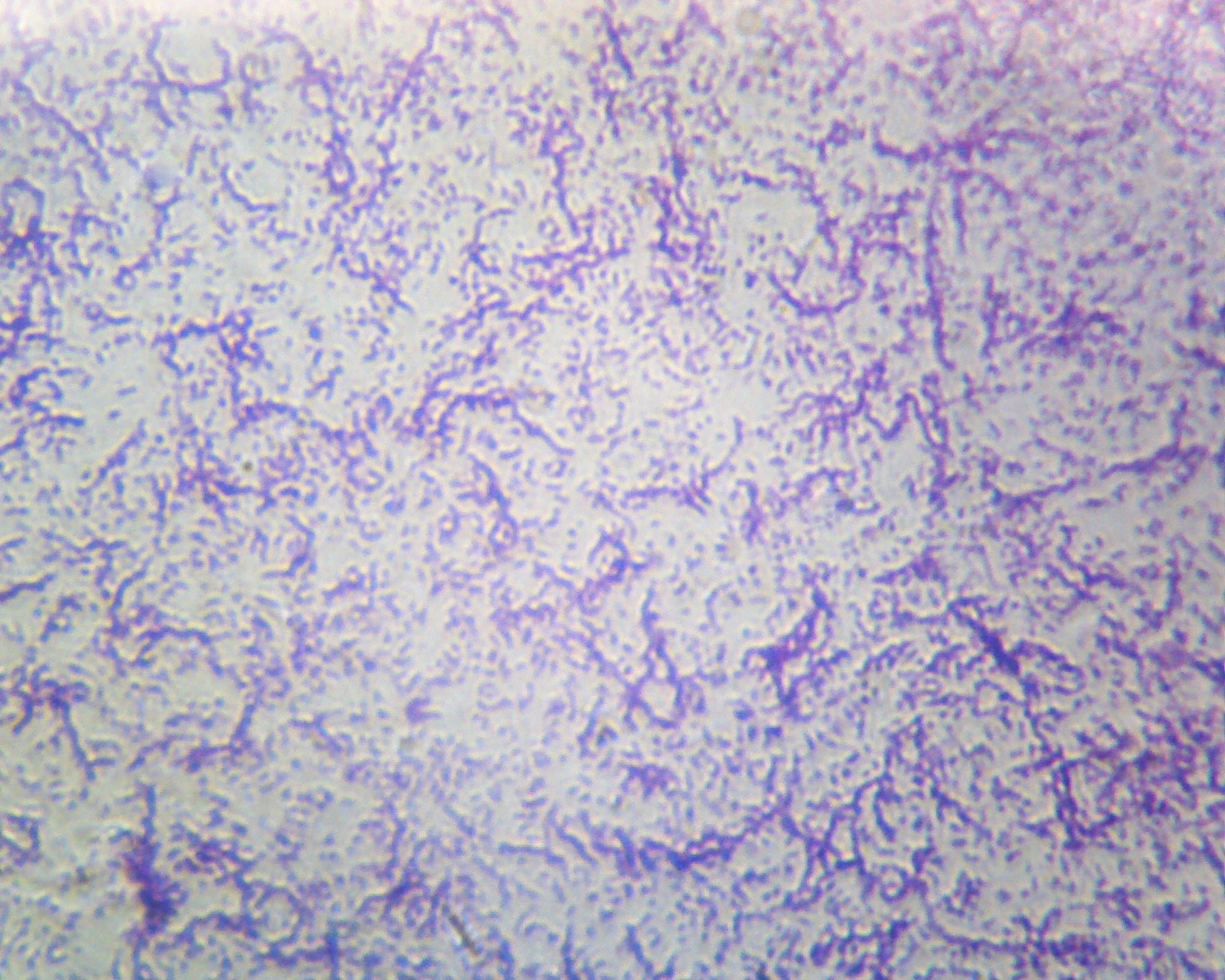 Typical Bacteria Mix of Cocci, Bacilli and Spirilli; Smear