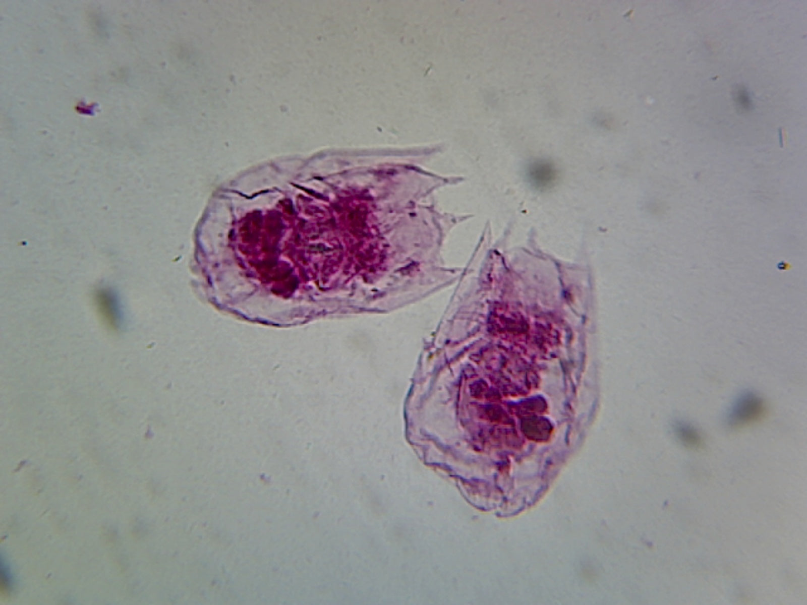 Prepared Microscope Slide, Vorticella (Ciliate, Peritrich)