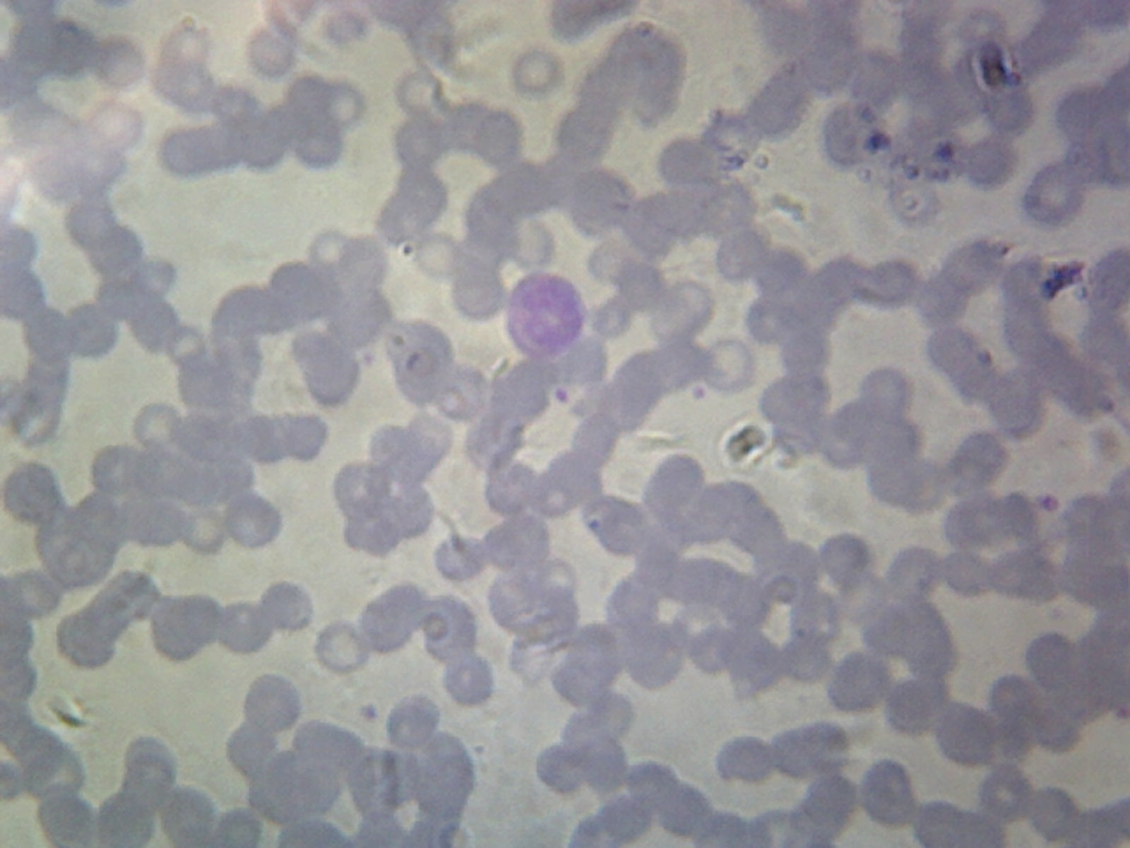 Balantidium Coli Trophozoites; Smear by Go Science Crazy