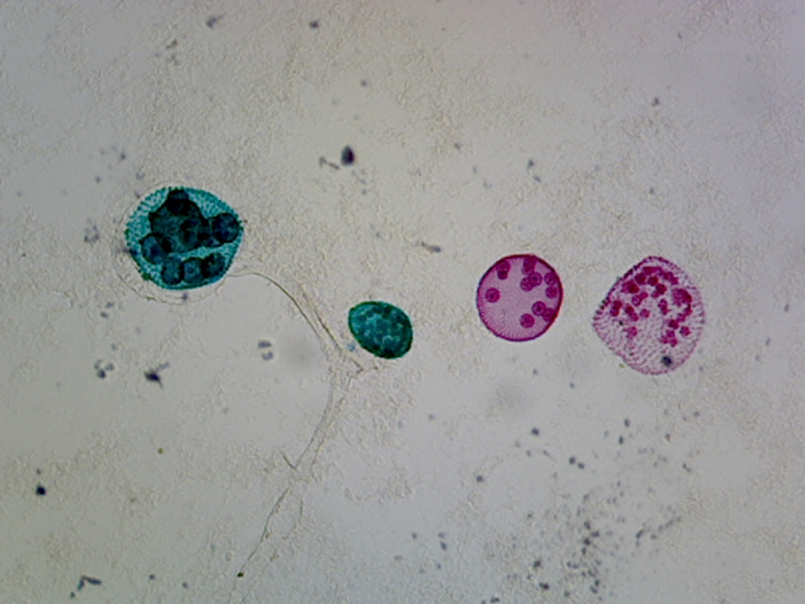 Volvox Sexual Reproduction; Showing Sex Cells; Whole-mount