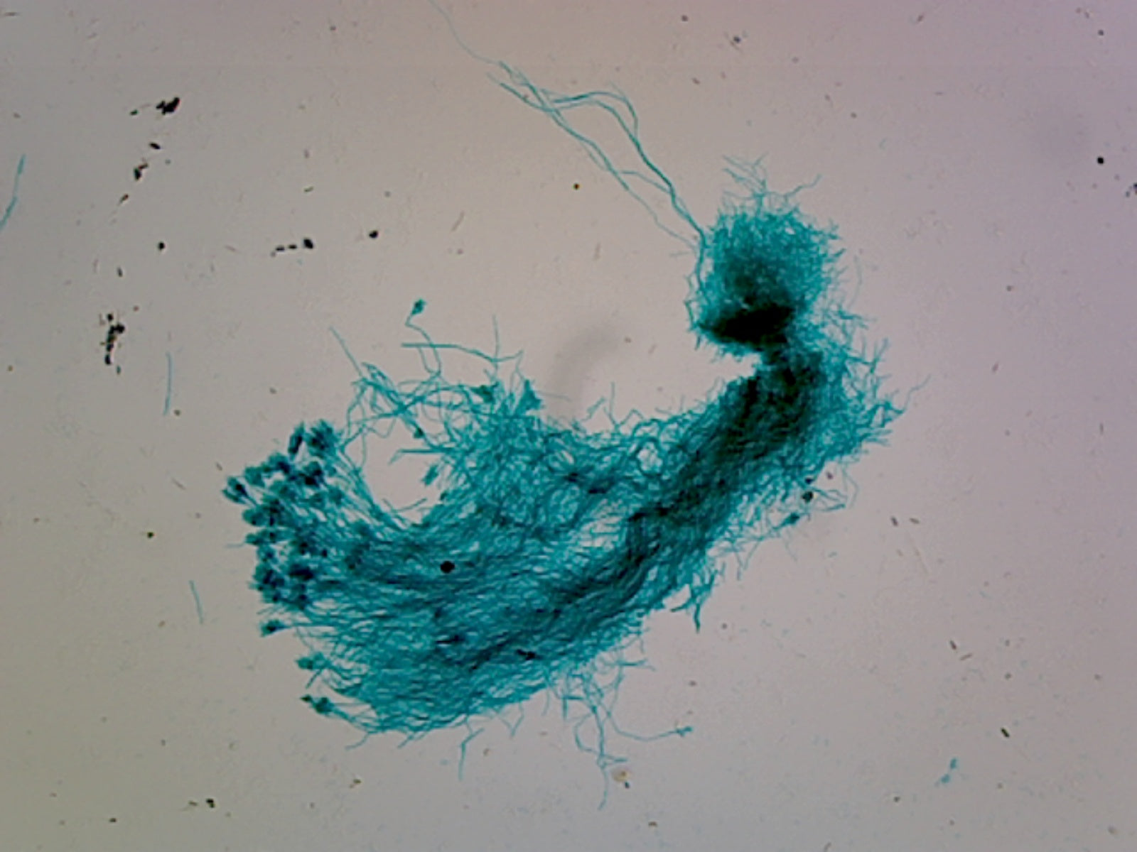 Penicillium; Section Showing Conidiophores with Conidia