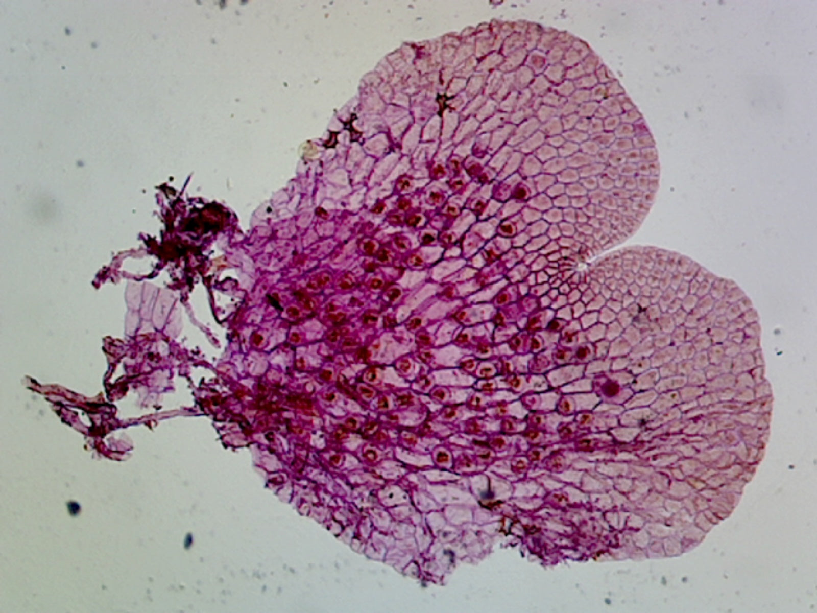 Fern (Pteridophyta) Prothallium, Showing Gametophytes; Cross Section