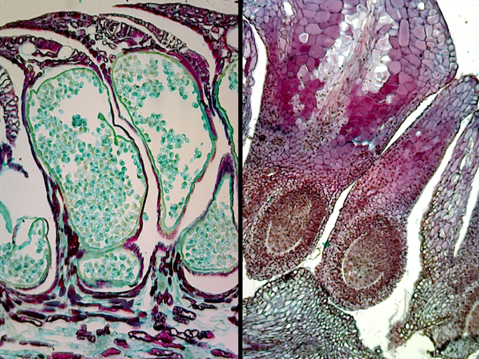 Pine (Gymnosperms) Life History Composite; Showing Five Stages