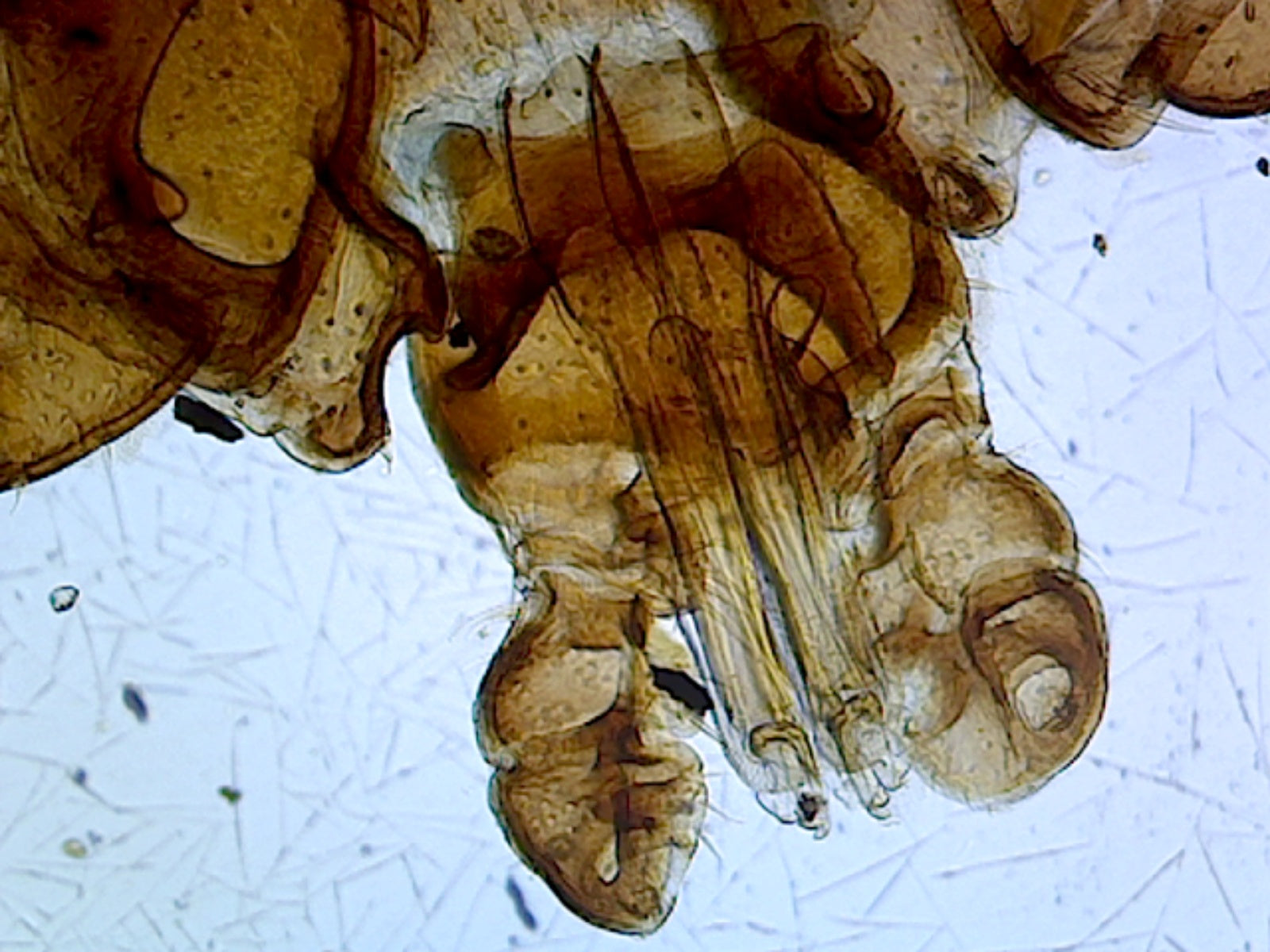 Tick (Arachnid); Whole-mount