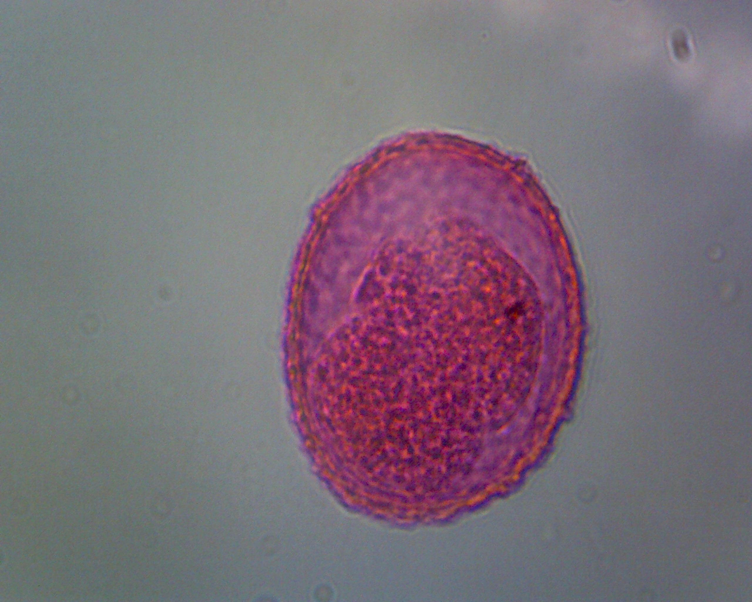 Slide, Ascaris Lumbricoides Eggs; Whole-mount