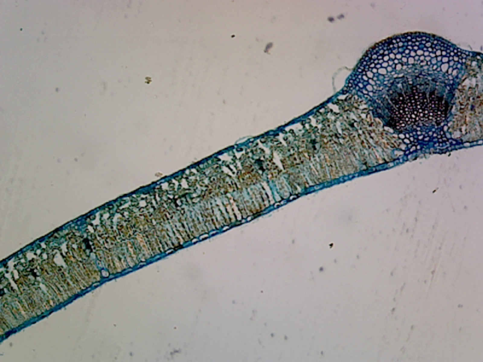Syringa Vulgaris Leaf; Cross Section