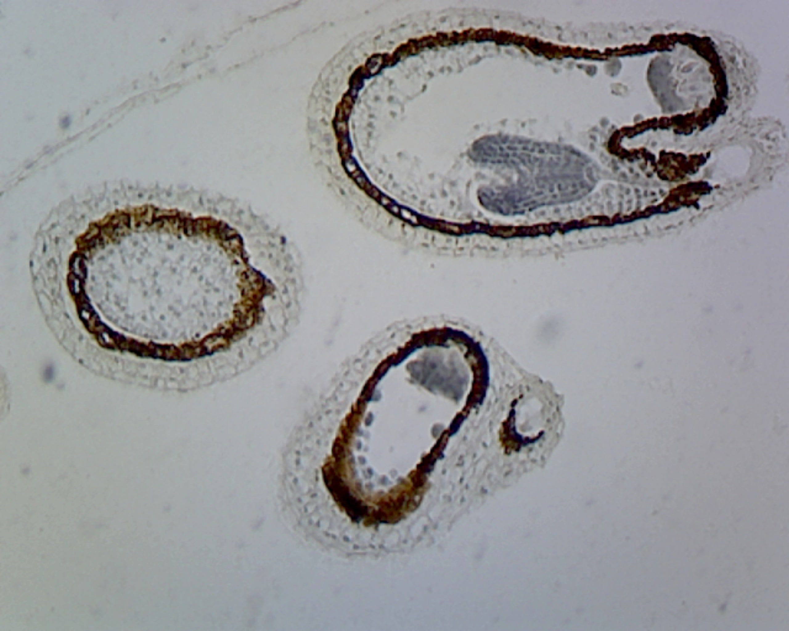Capsella Embryo, Precotyledon Stage; Lateral Section by Go Science Crazy