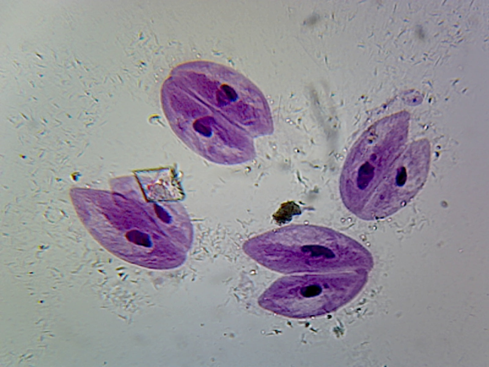 Paramecium Conjugation; Whole-mount