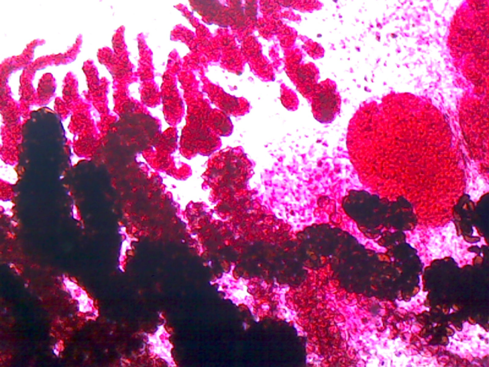 Clonorchis Sinensis, Human Liver Fluke; Whole-mount