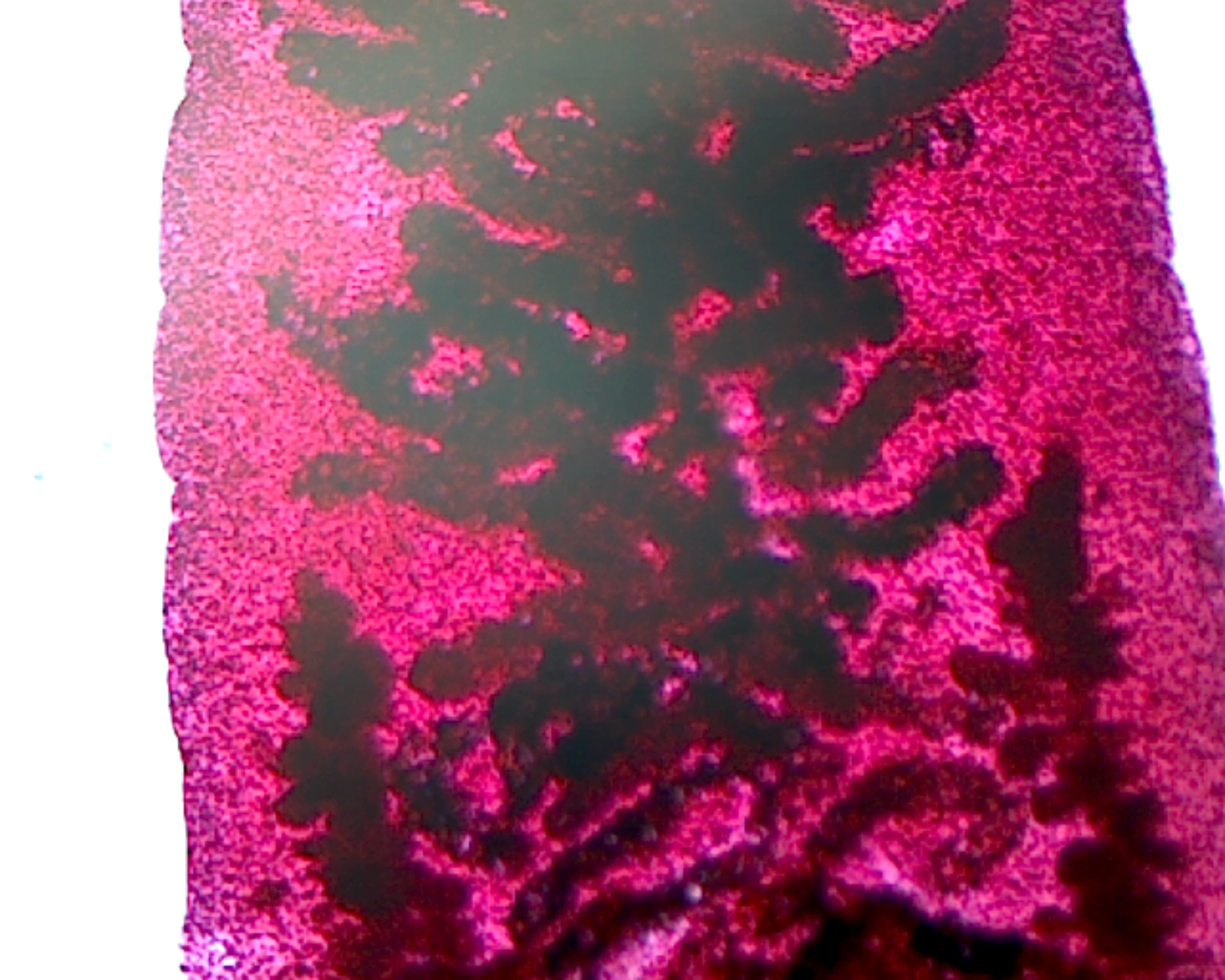 Fasciola Hepatica; Whole-mount by Go Science Crazy