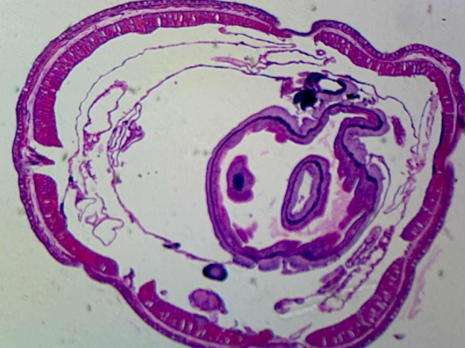 Earthworm Setae; Cross Section; M Stain by Go Science Crazy