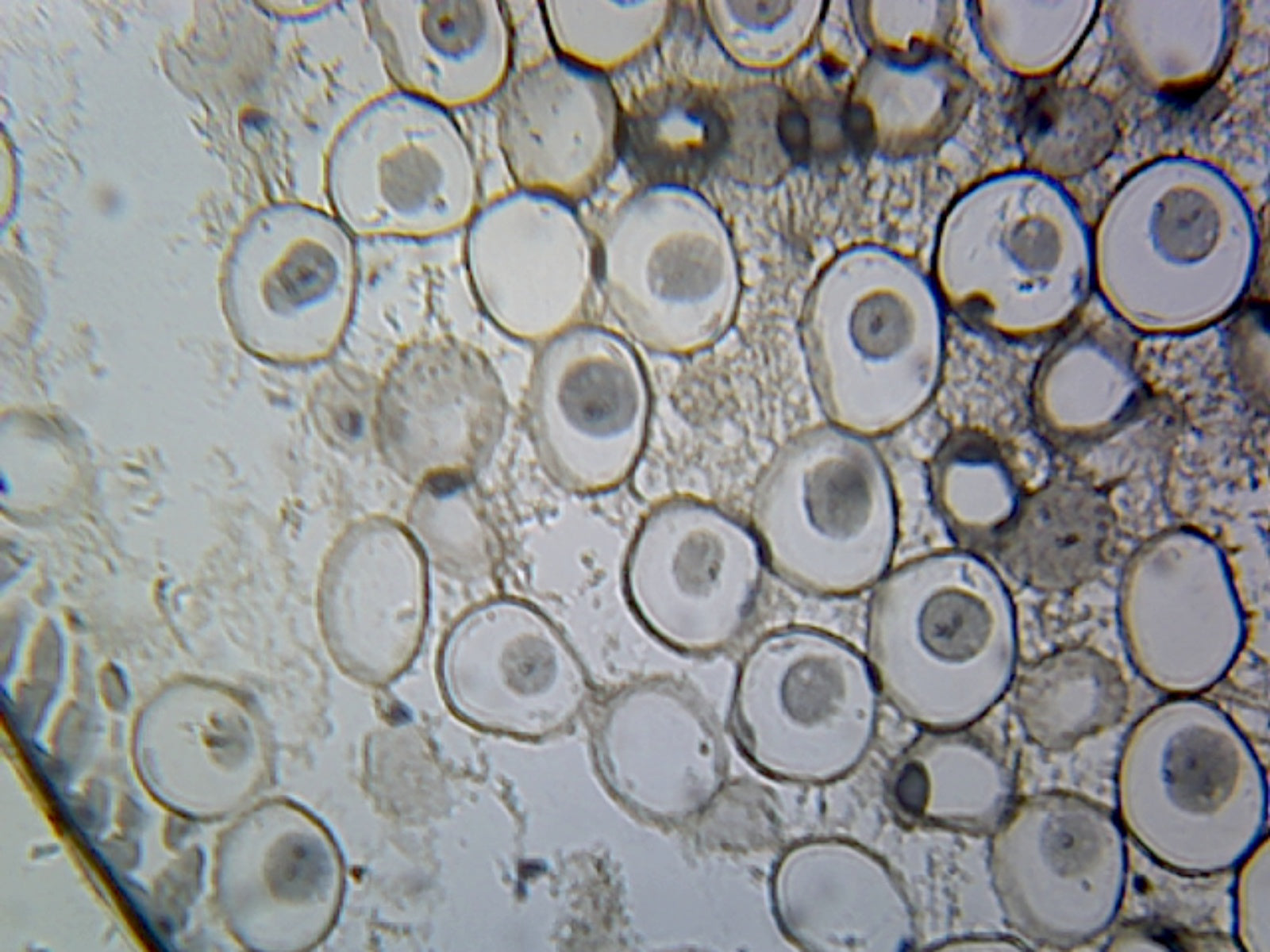 Centrioles, from Animal Cells; Section