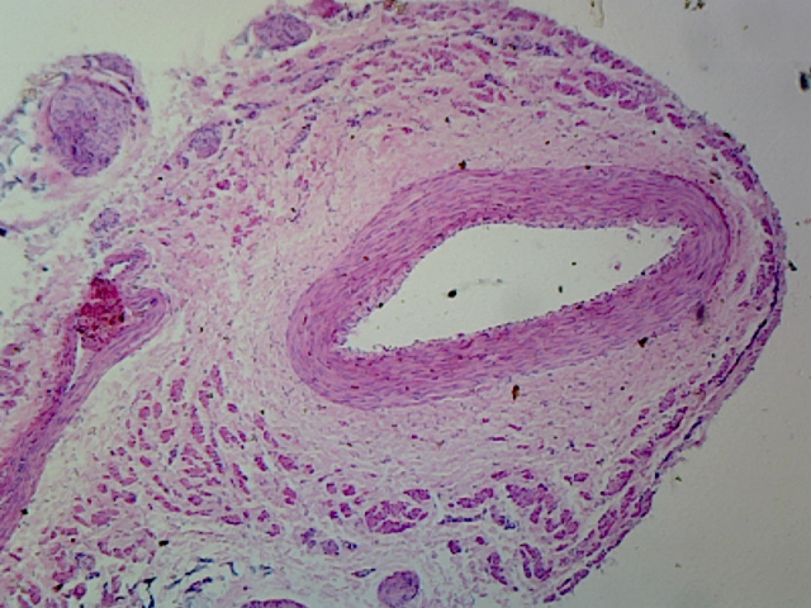 Medium-Sized Artery and Vein, Mammalian; Cross Section