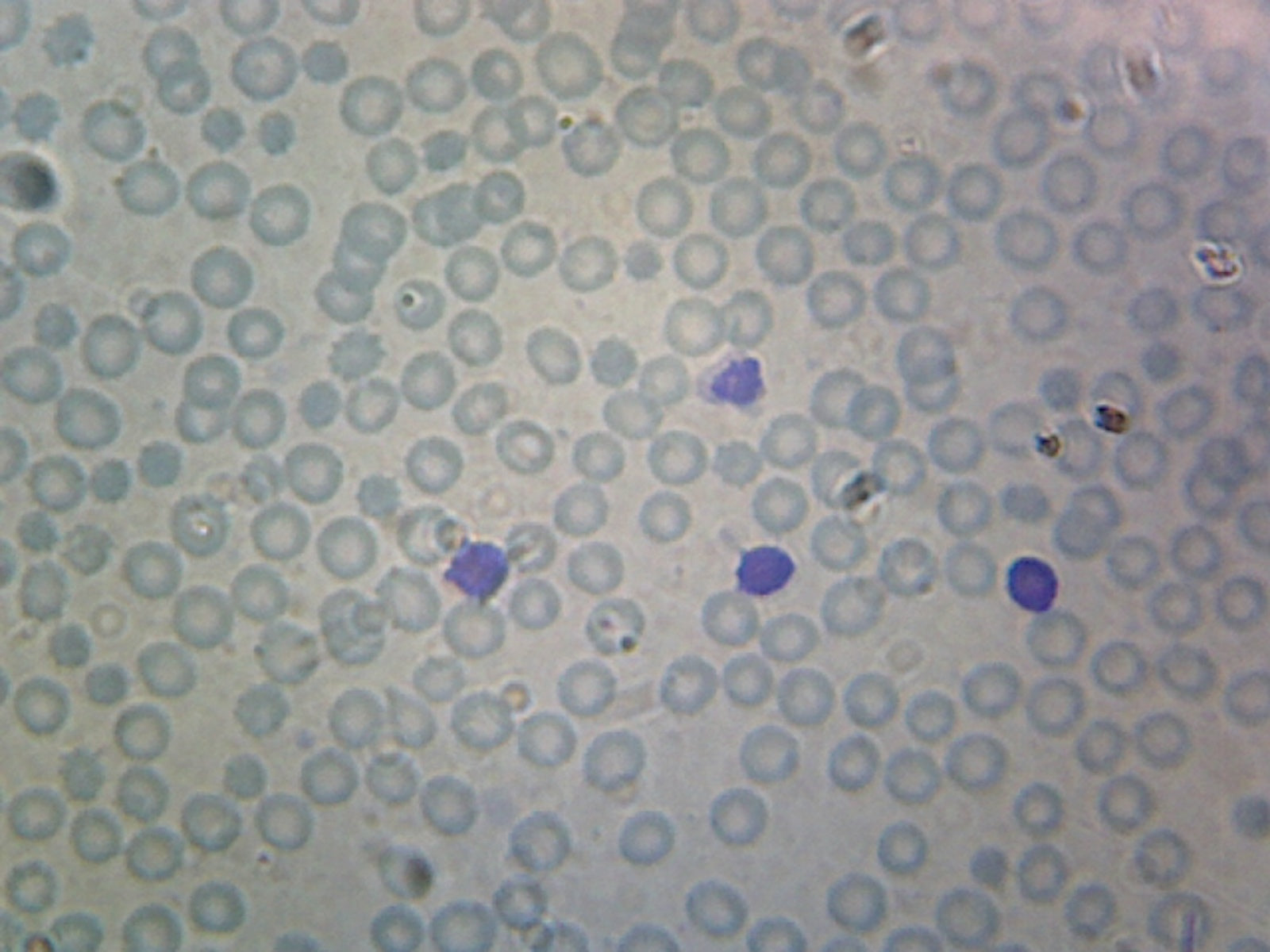 Human Blood; Smear; WR Stain by Go Science Crazy