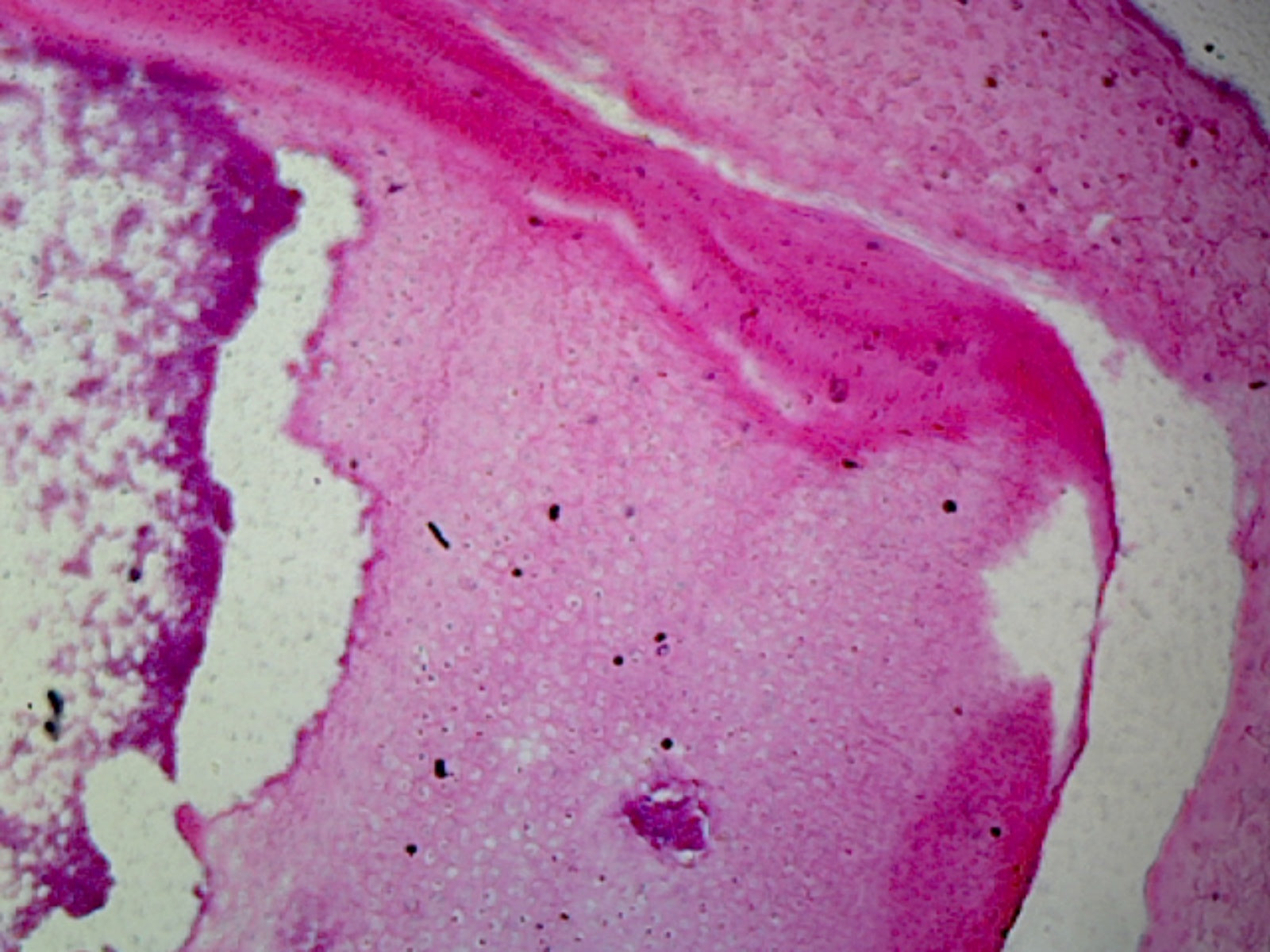 Red Bone Marrow, Mammalian; Showing Giant Blood Cells; Section; H&E Stain by Go Science Crazy