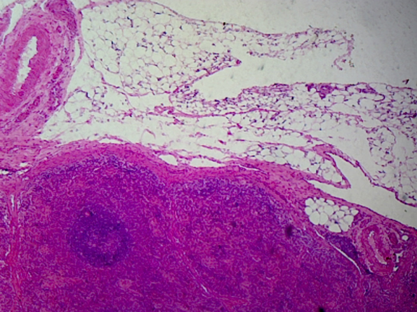 Spleen, Mammalian; Section; H&E Stain