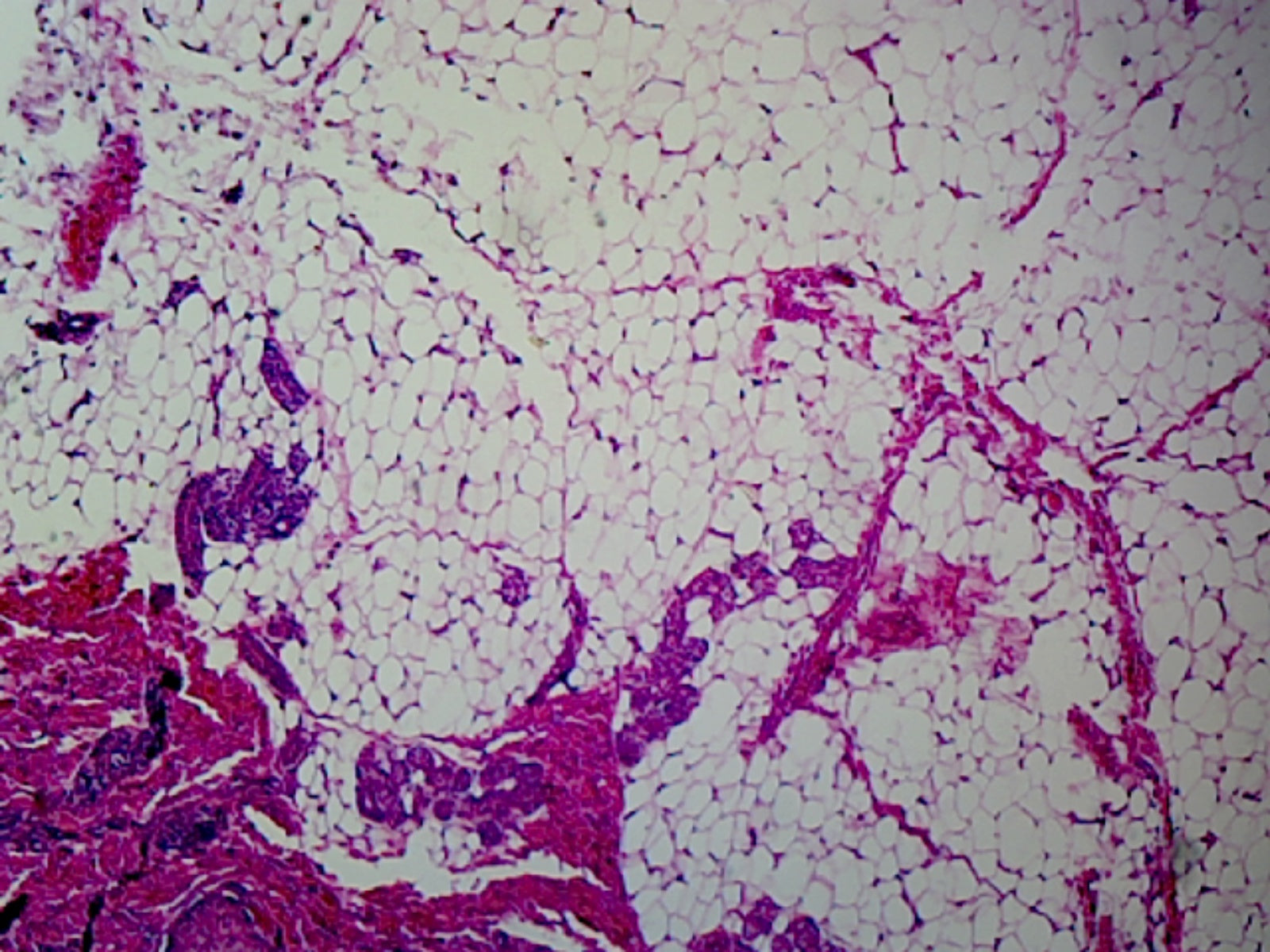 Slide, Adipose Tissue, Mammalian; Section; H&E Stain