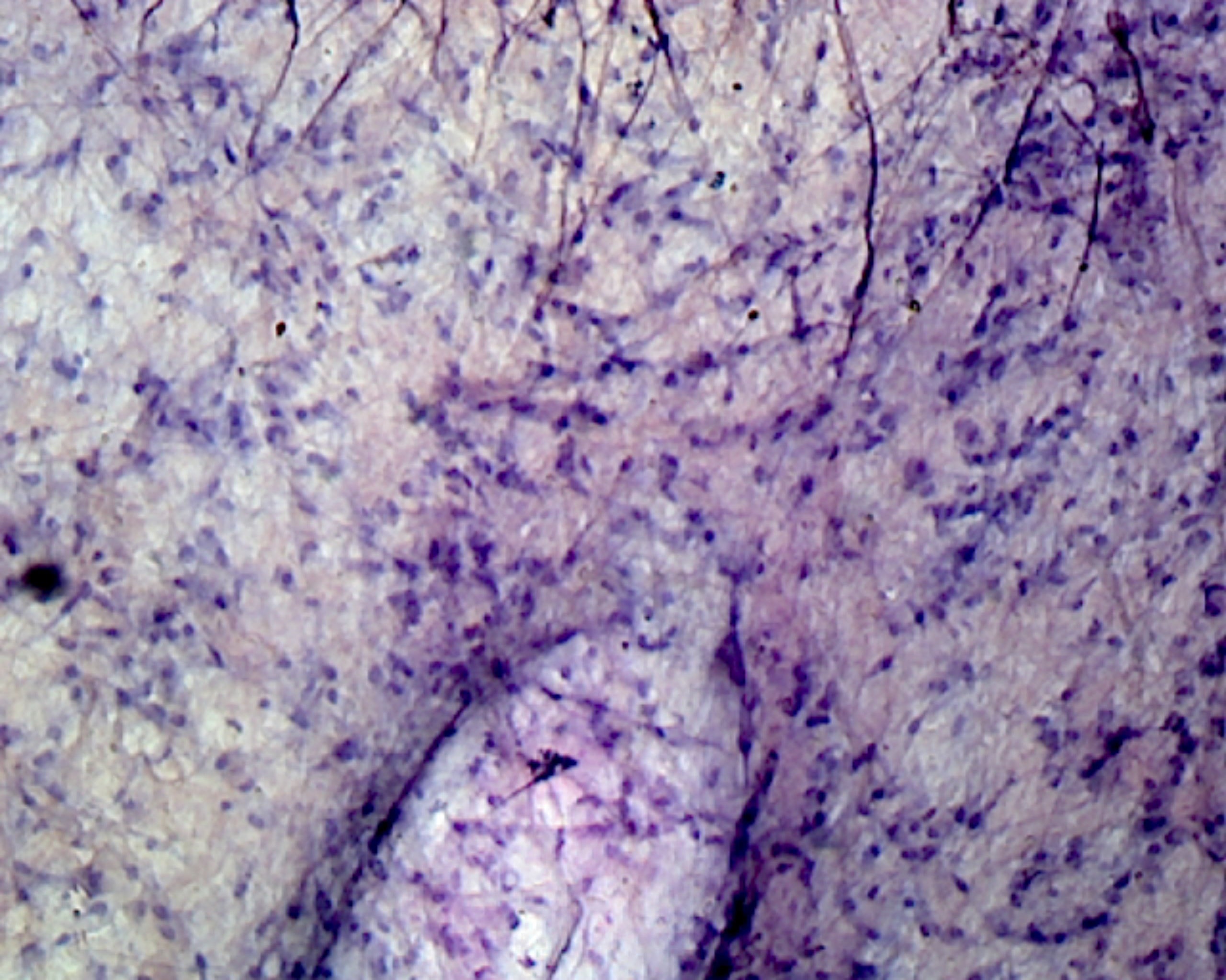 Slide, Areolar Tissue, Mammalian; Section