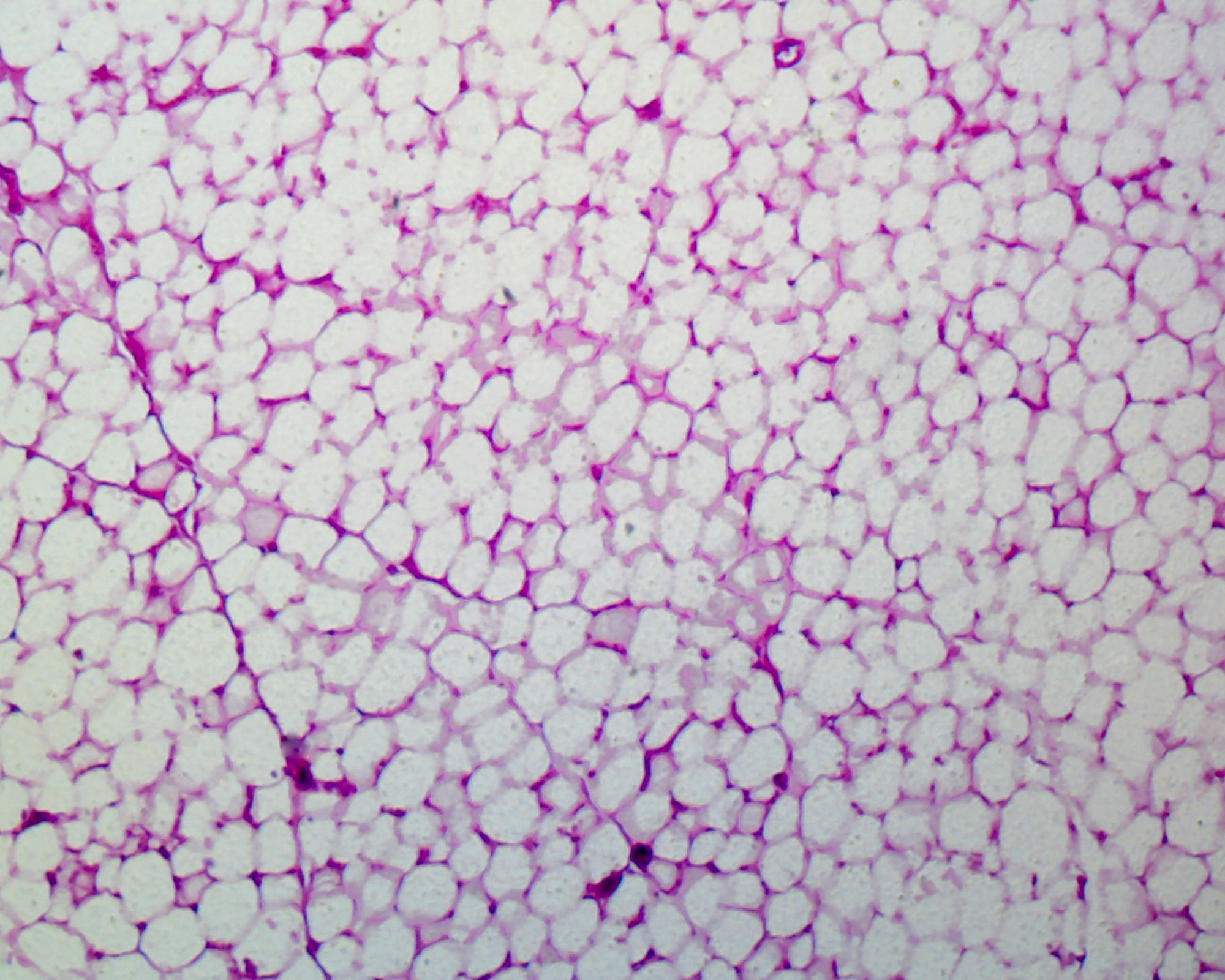 Slide, Adipose Tissue, Human; Section
