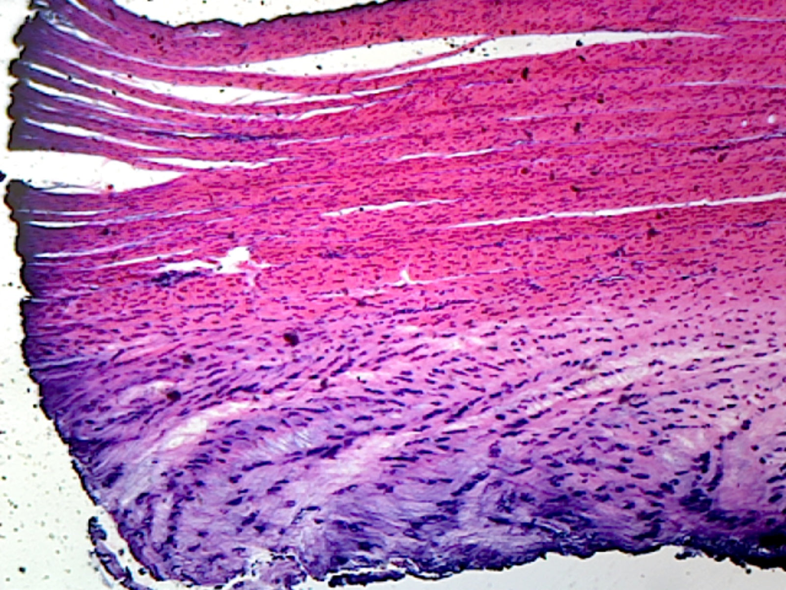 White Fibrocartilage from Intervertebral Disc, Mammalian; Section