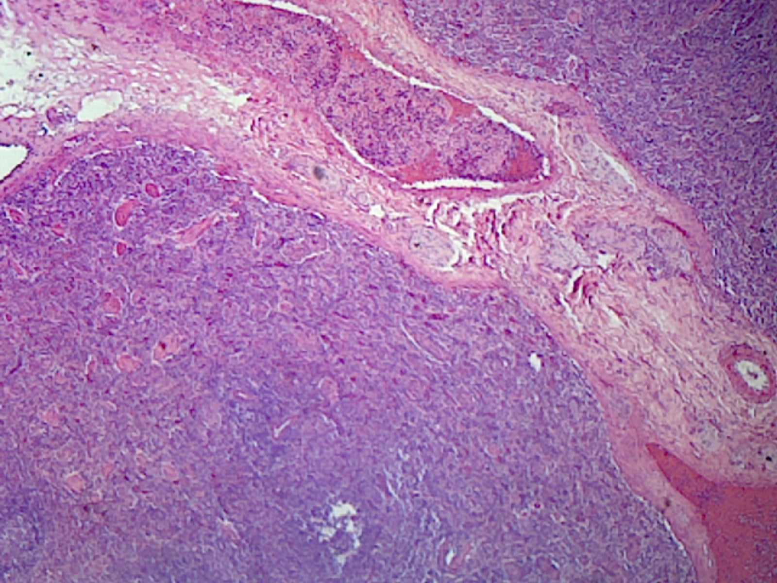 Human Spleen; Section; H&E Stain