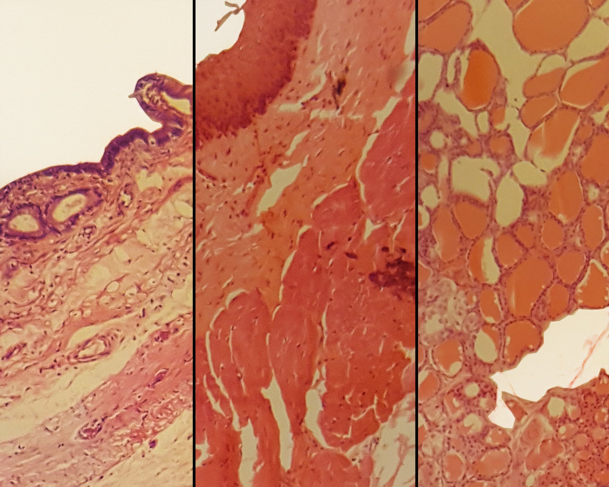 Mammalian Epithelium Composite; Showing Stratified Squamous, Simple Columnar, and Simple Cuboidal Epithelium; Sections by Go Science Crazy