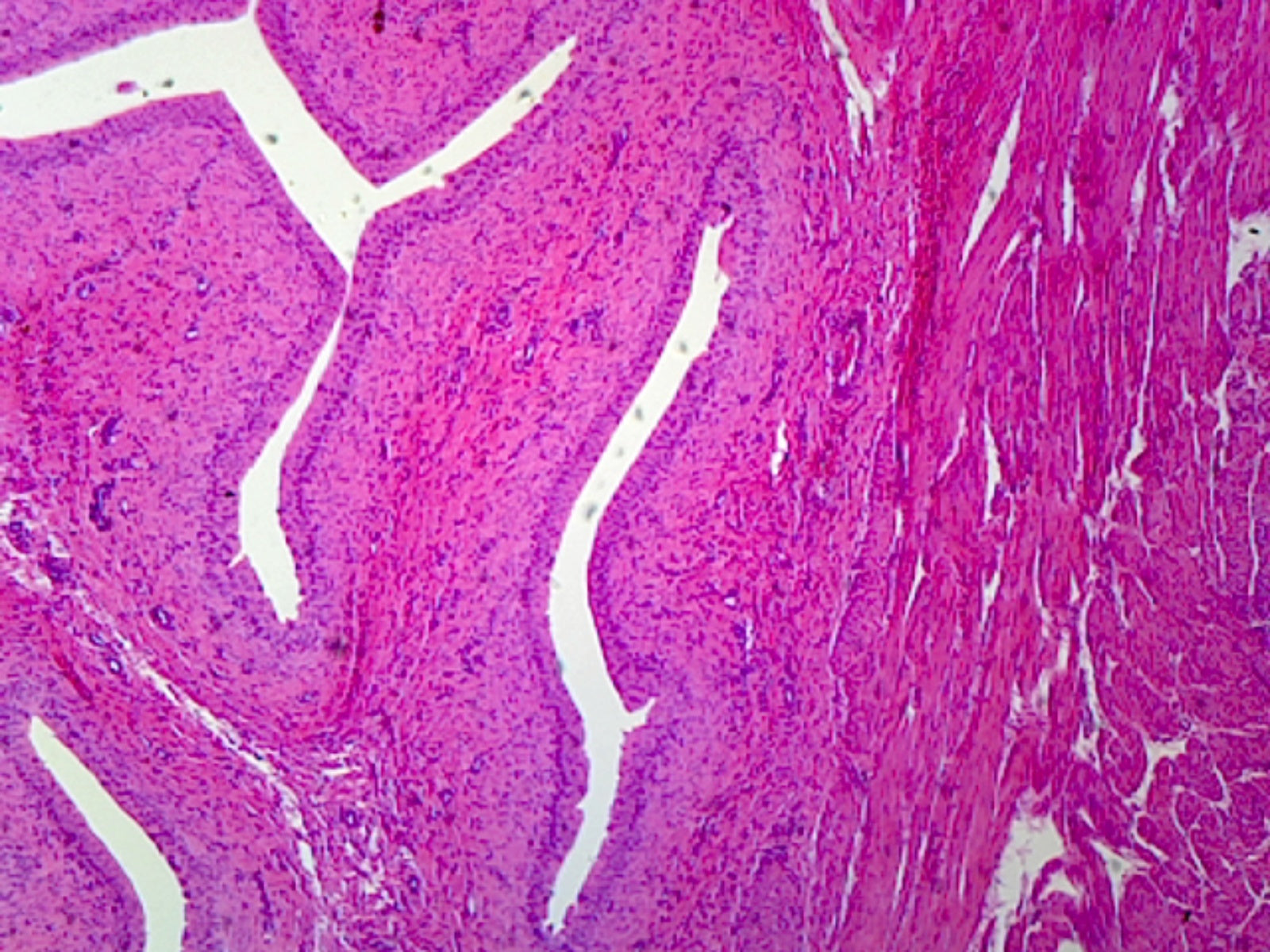 Transitional Epithelium, Mammalian; Stratified Cuboidal Epithelium from Urinary Bladder; Section