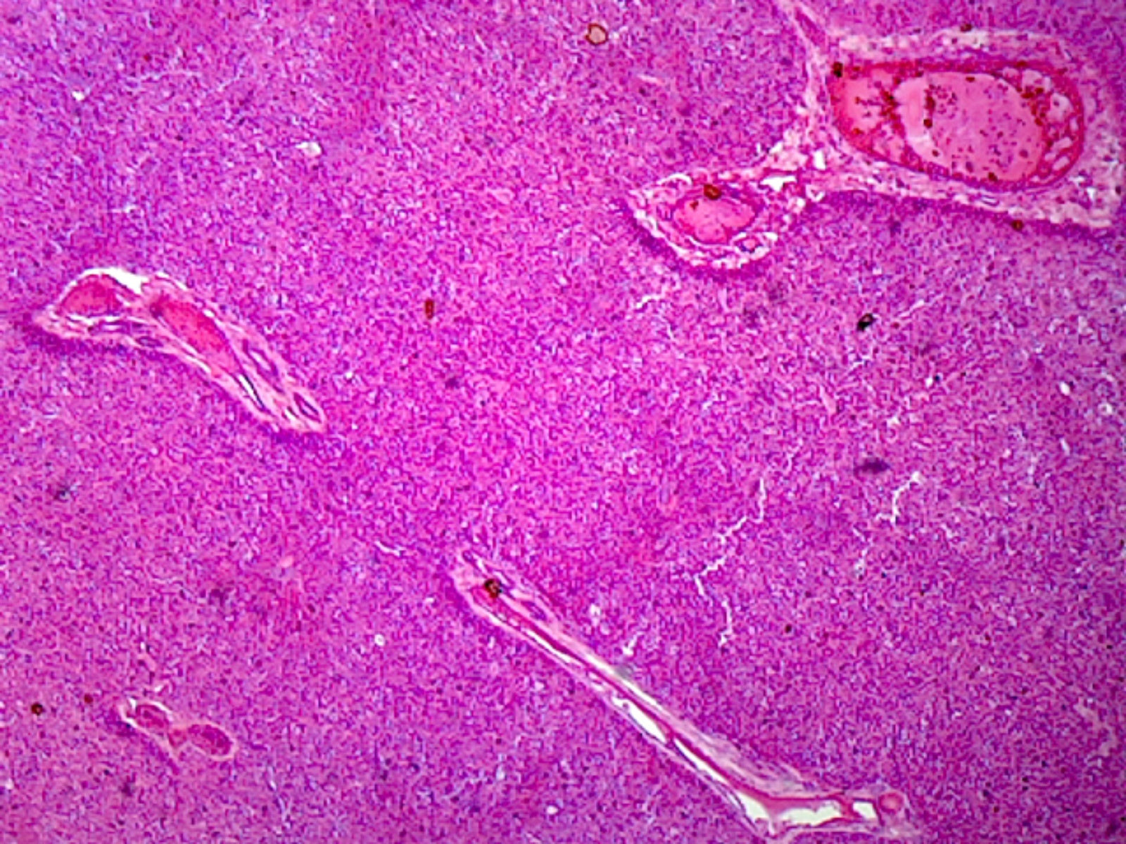 Liver, Mammalian; Showing Hepatic Cells; Section; H&E Stain
