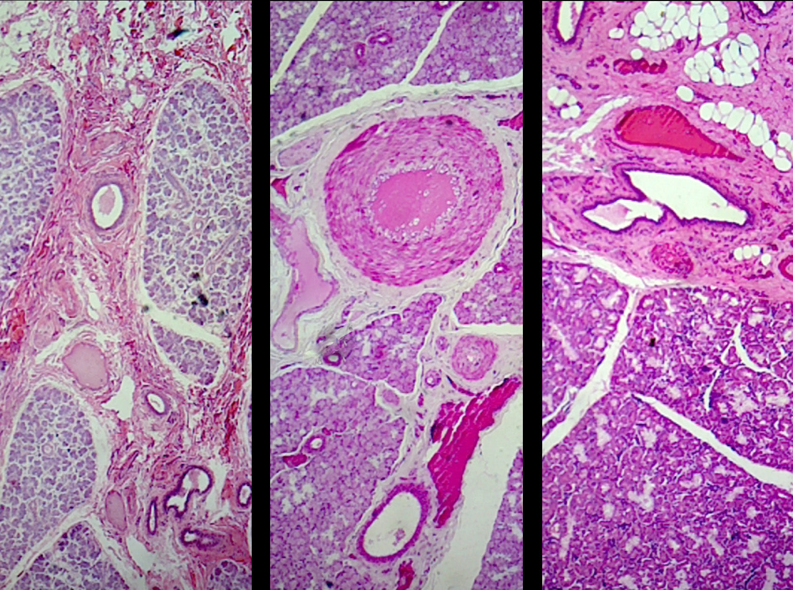 Mammalian Salivary Glands Composite; Showing Sublingual, Submaxillary, and Parotid Gland; Sections; H&E Stain by Go Science Crazy