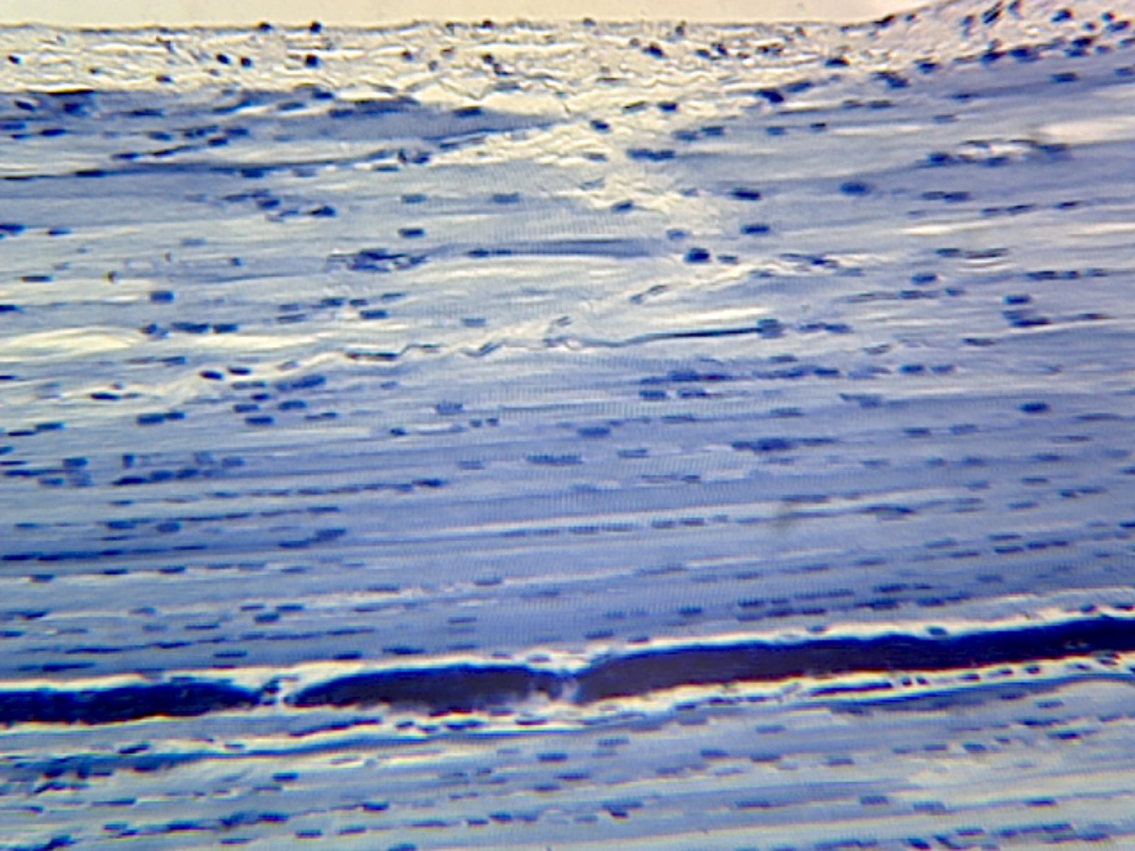 Skeletal Muscle, Human; Longitudinal Section