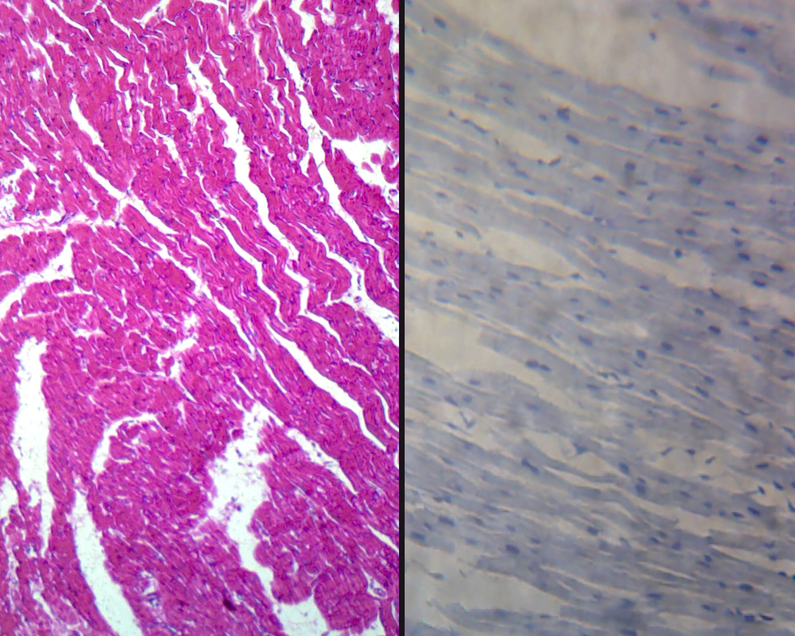 Cardiac Muscle, Mammalian; Cross Section and Longitudinal Sections by Go Science Crazy