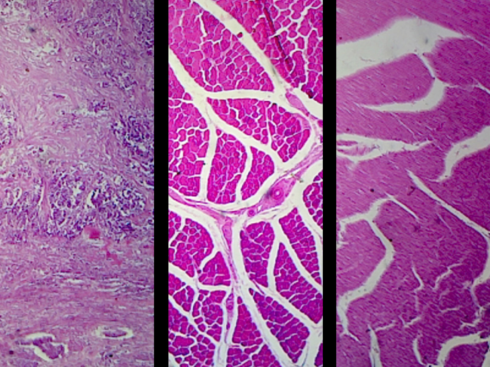 Mammalian Muscle Types Composite; Showing Smooth, Cardiac, and Skeletal Muscle; Section; H&E Stain