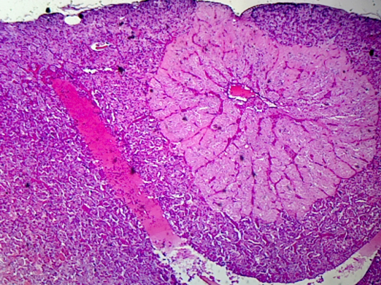 Hypophysis (Pituitary Gland); Section