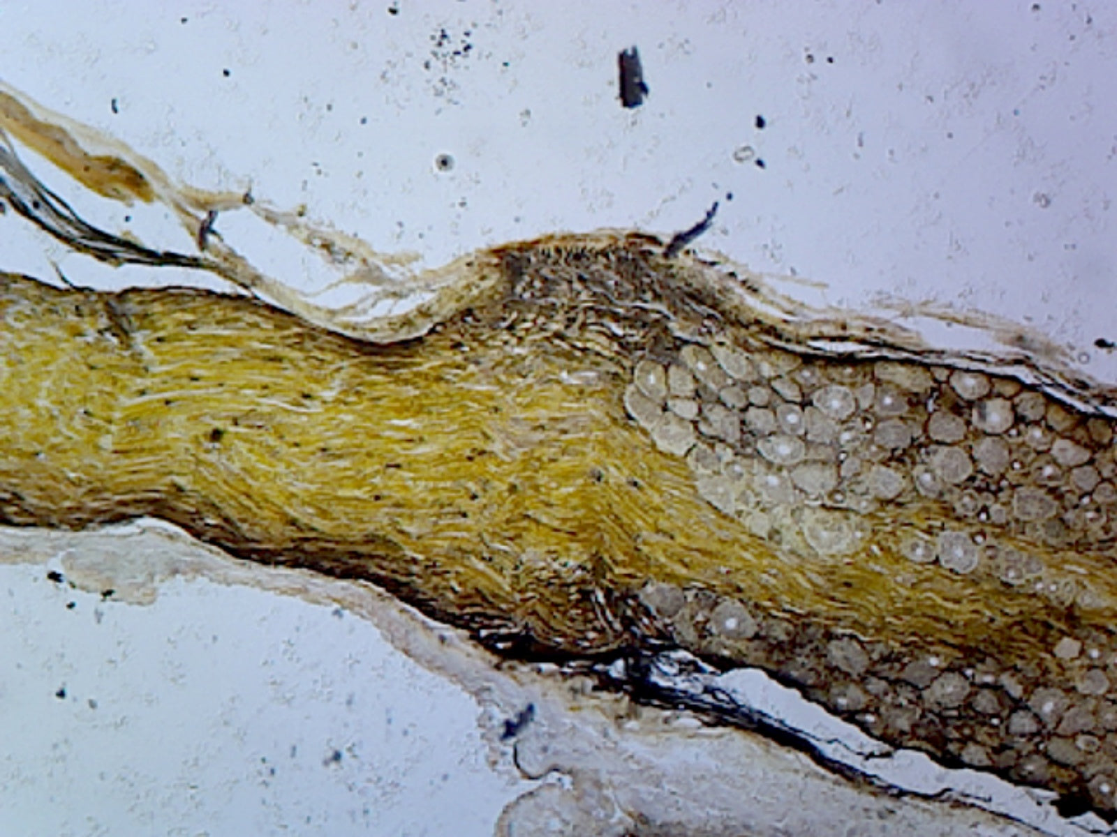 Golgi Complex from Spinal Ganglion, Mammalian; Section