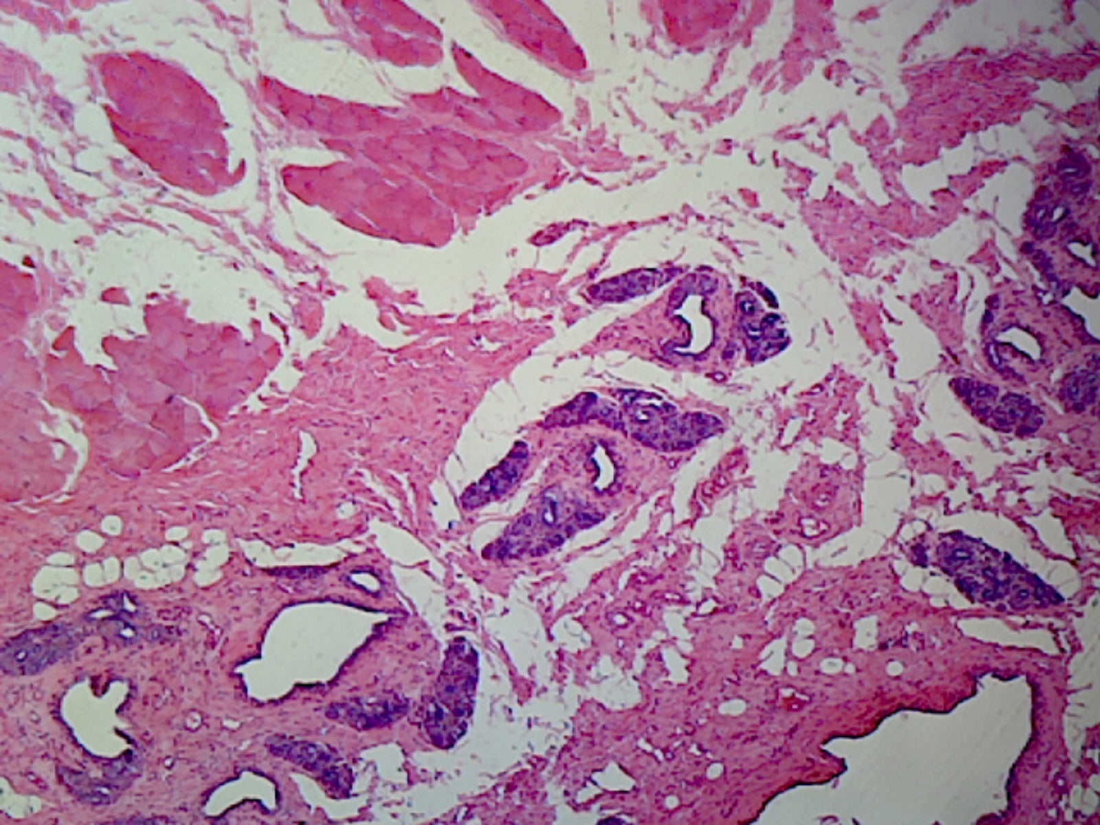 Mitochondria from Pancreas or Intestine Cells, Mammalian; Section