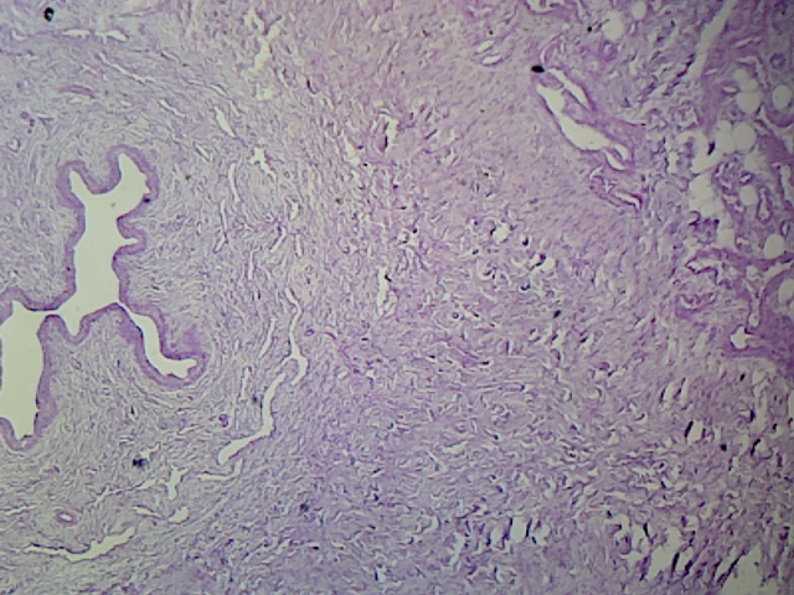 Penis, Mammalian; Showing Urethra and Corpora Cavernosa; Cross Section; H&E Stain