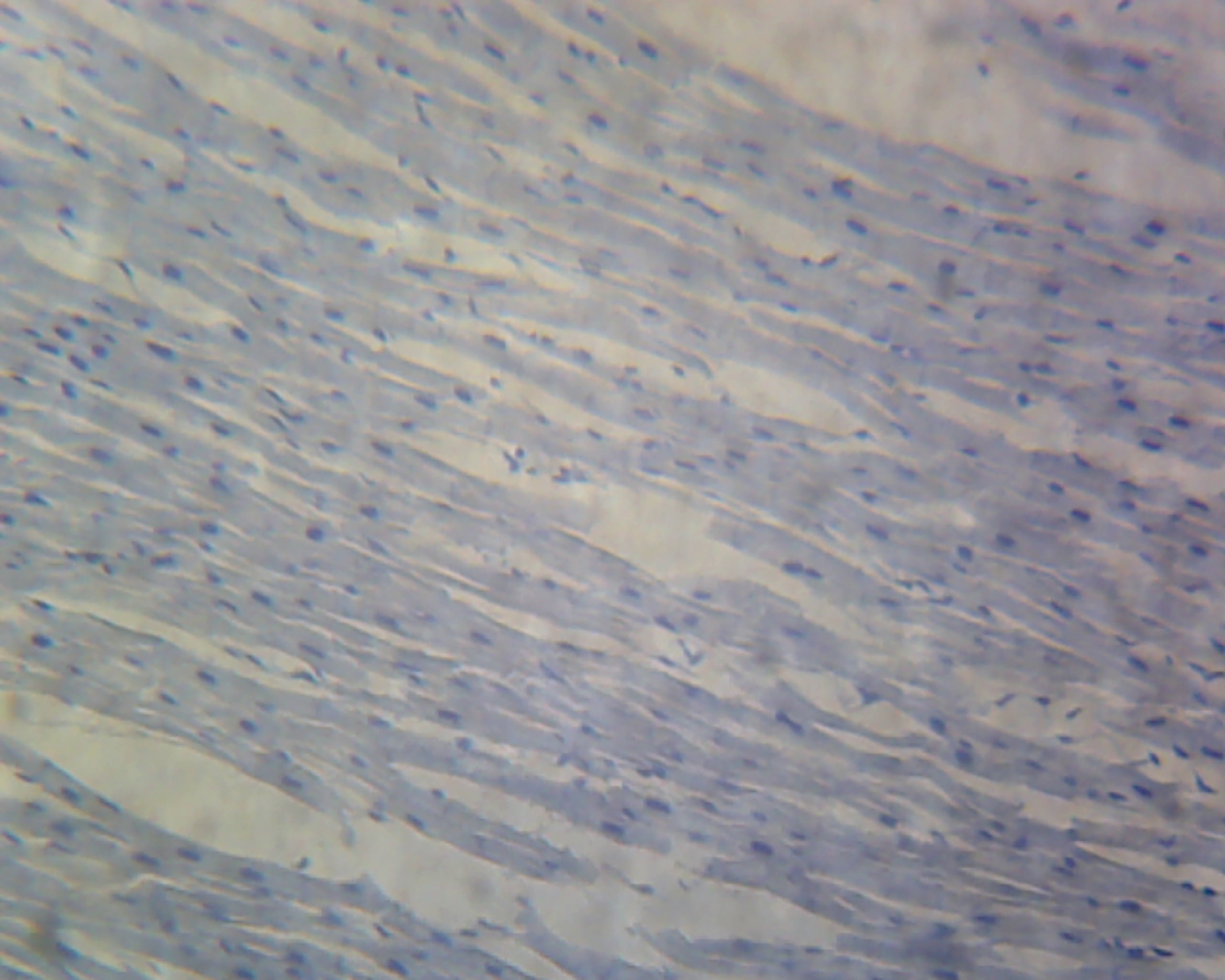 Cardiac Striated Muscle, Longitudinal Section, Mammal.