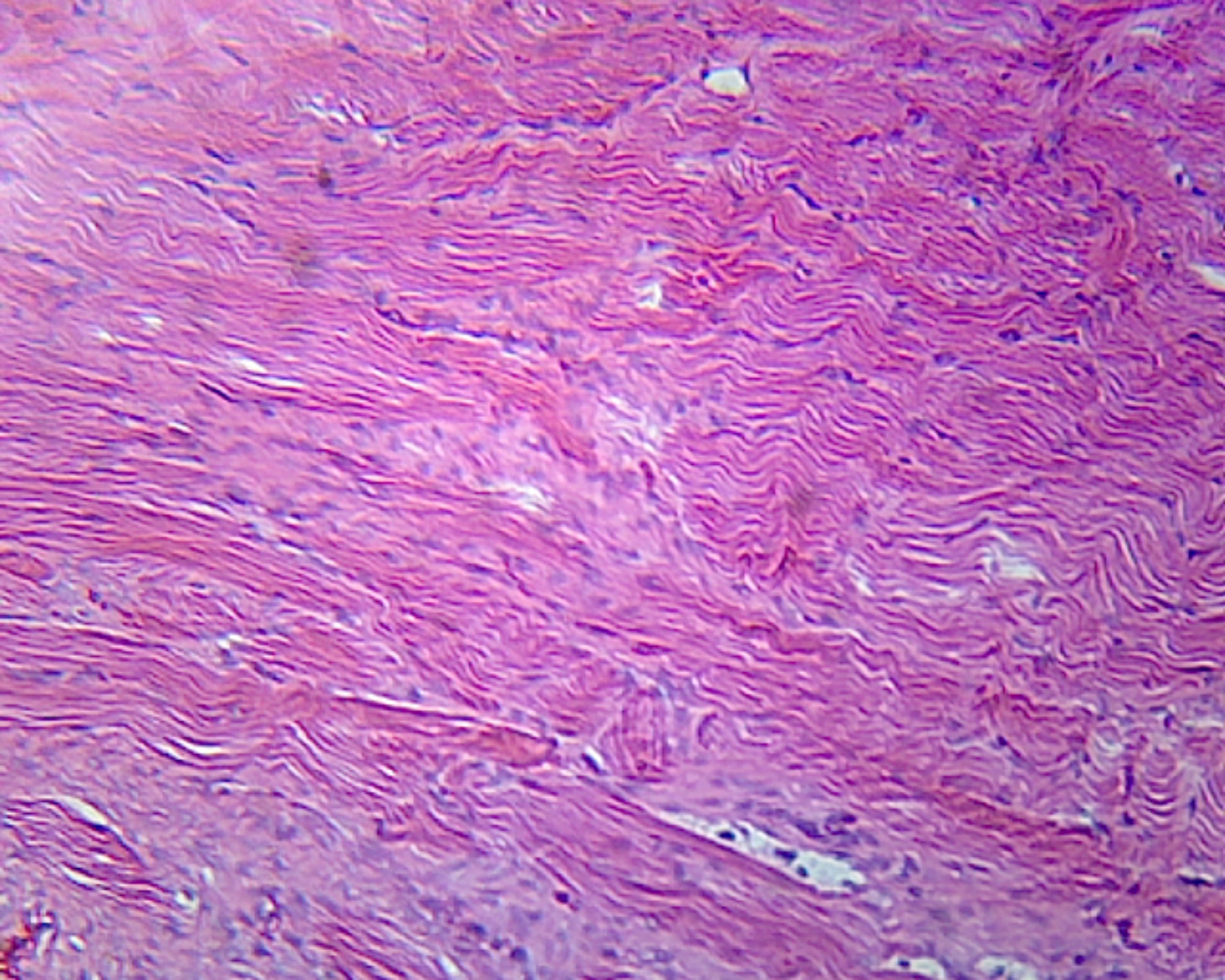 Female Urethra, Mammalian; Cross Section