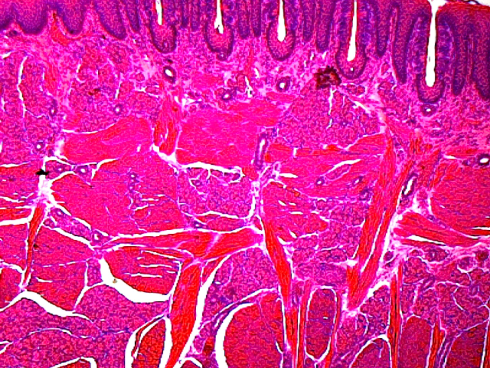 Foliate Papillae (Taste Buds), Mammalian; Section