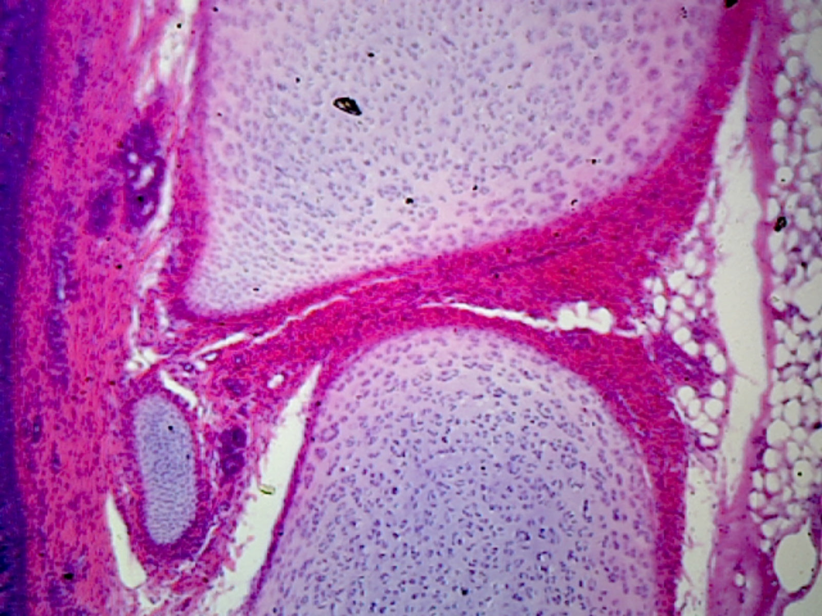 Trachea, Mammalian; Showing Ciliated Epithelium, Hyaline Cartilage, and Fibrous Tissue; Longitudinal Section