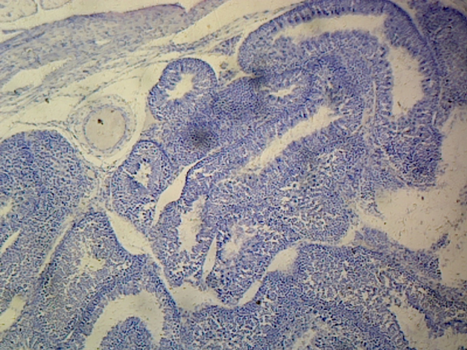 Testis; Section