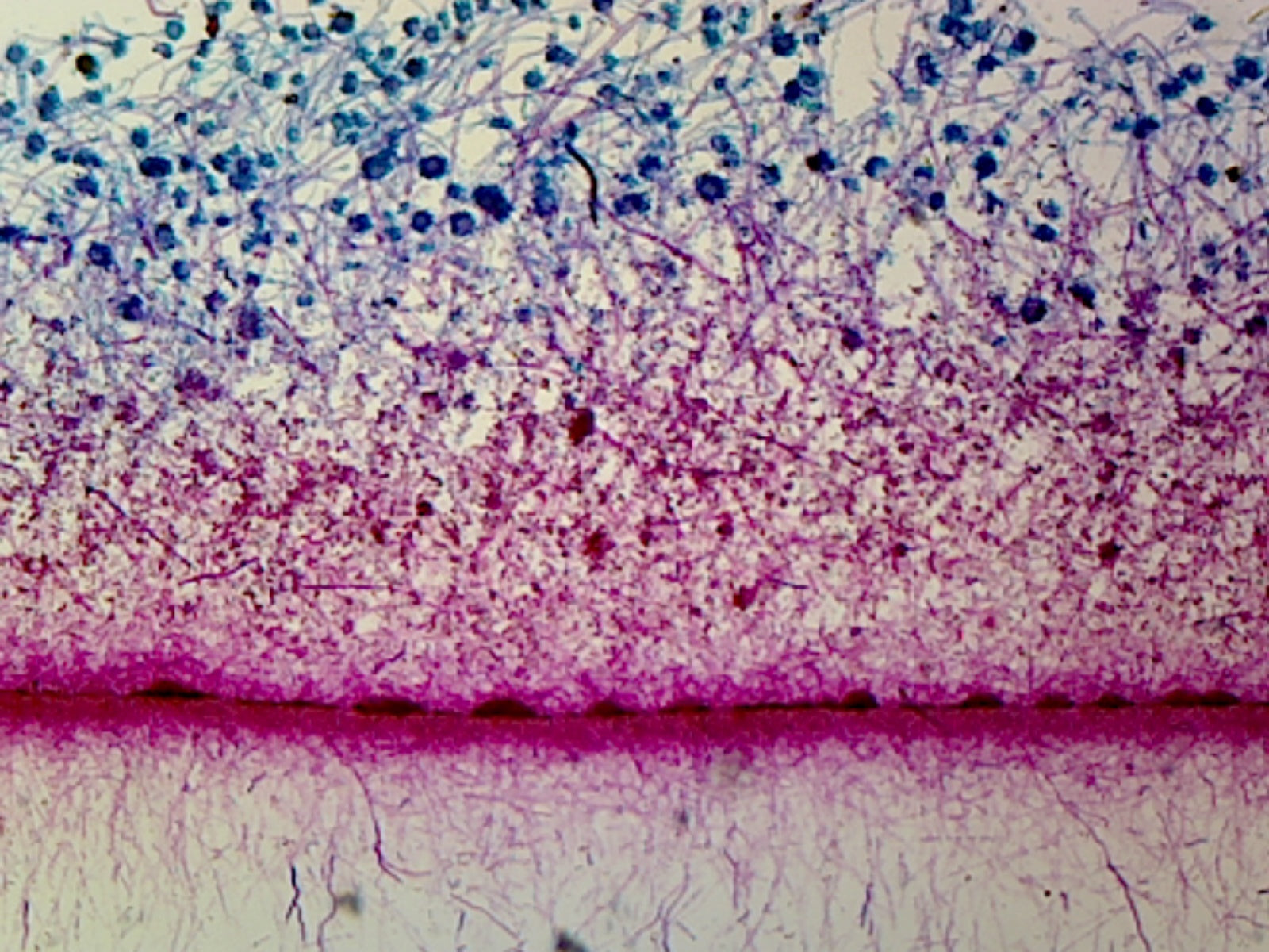 Slide, Aspergillus, Highly Aerobic Brown Mold; Whole-mount