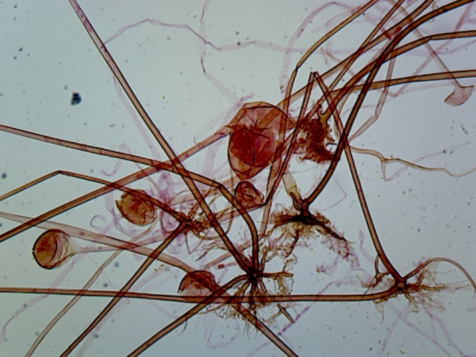 Rhizopus Asexual Reproduction; Whole-mount by Go Science Crazy