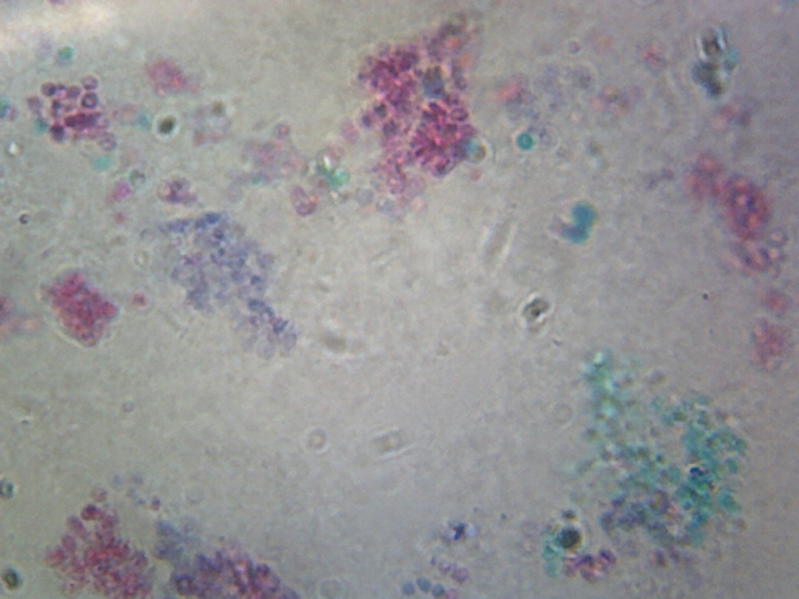 Saccharomyces Cerevisiae, Living Yeast; Whole-mount by Go Science Crazy