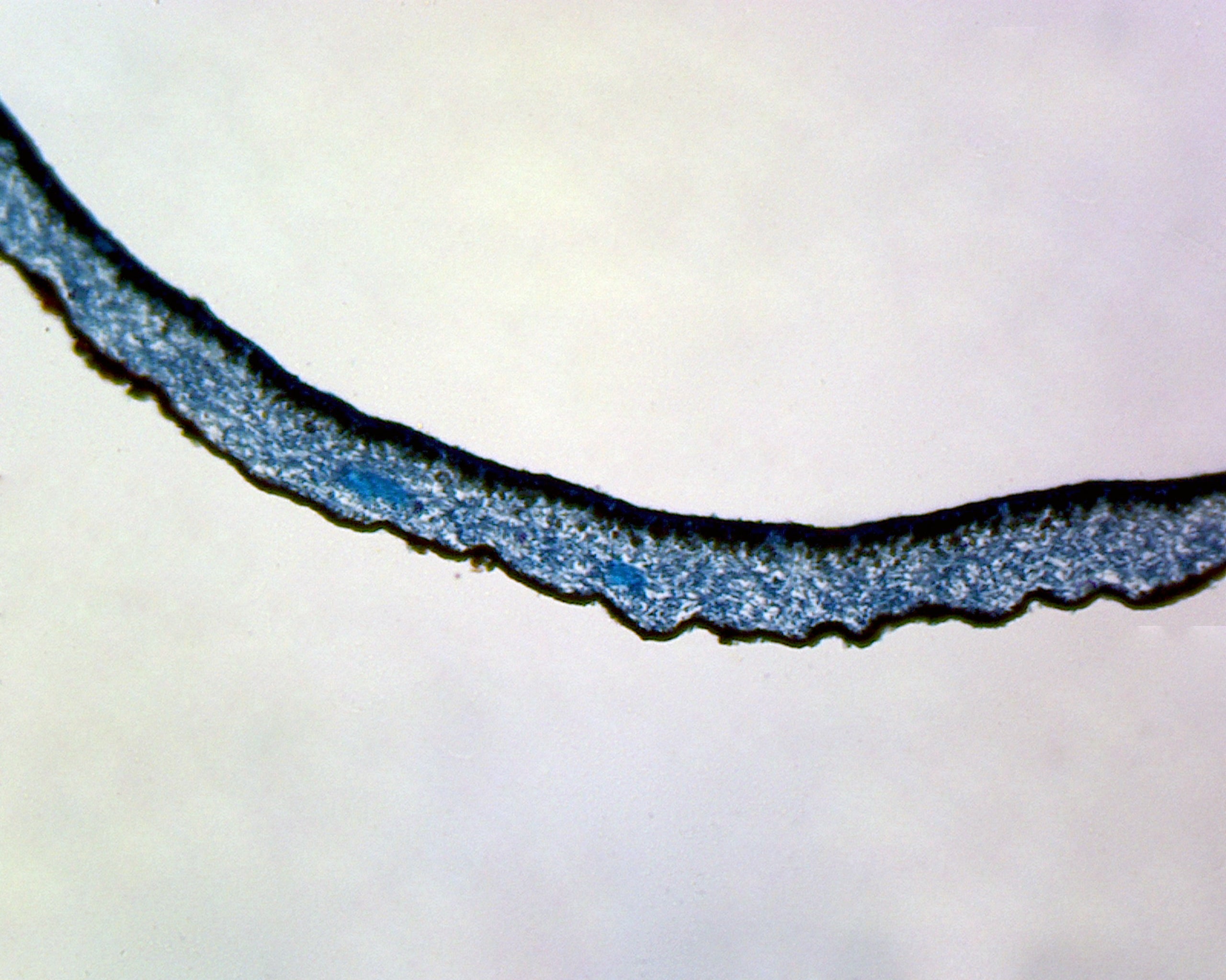 Lichen (Thallus Surrounded by Fungal Hyphae); Section