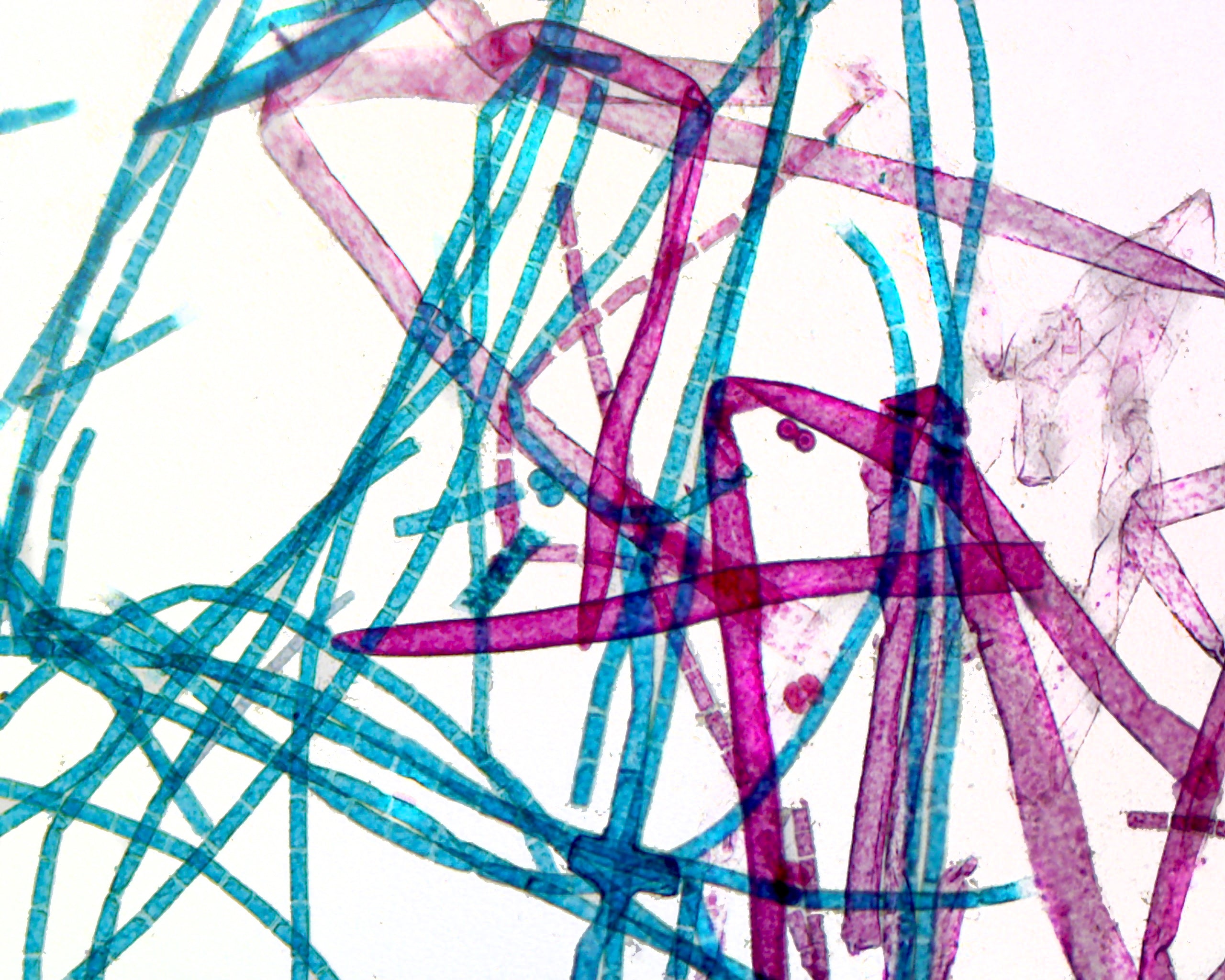 Branching Filamentous Cladophora; Whole-mount by Go Science Crazy