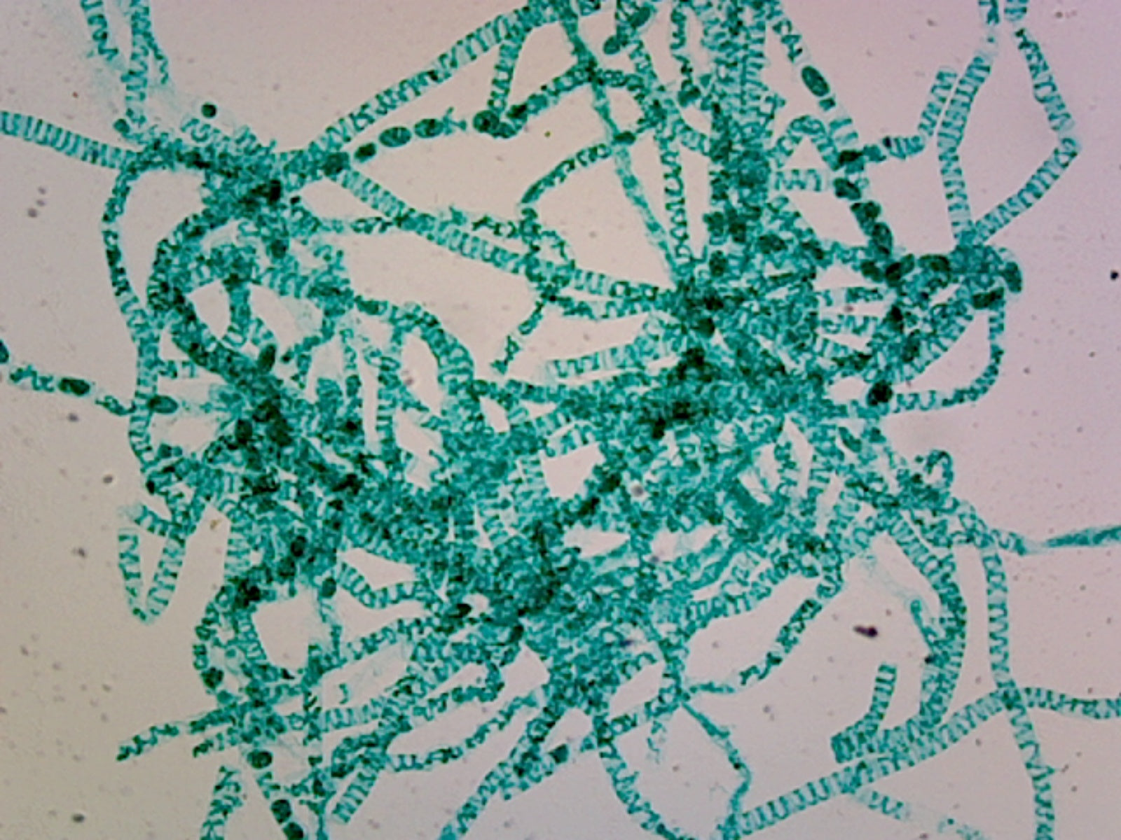 Spirogyra Scalariform Conjugation; Showing Zygote; Whole-mount