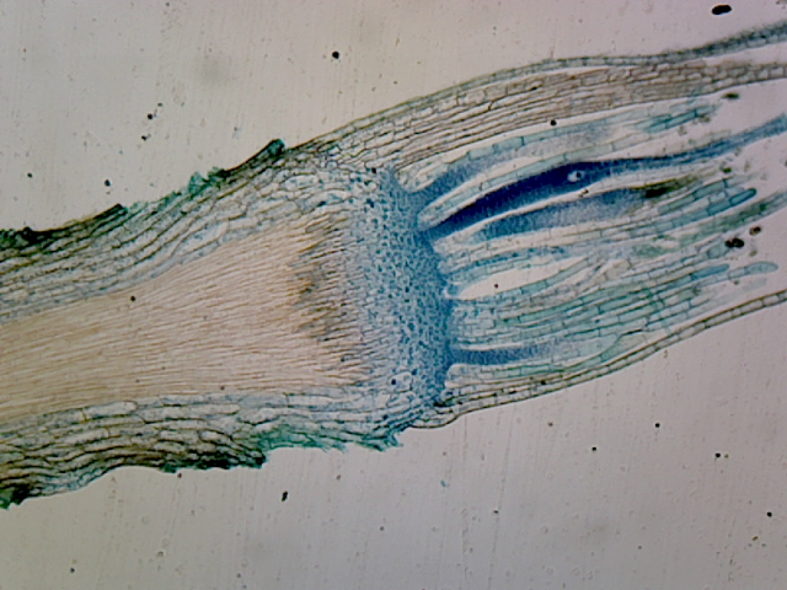 Moss Antheridia; Longitudinal Section