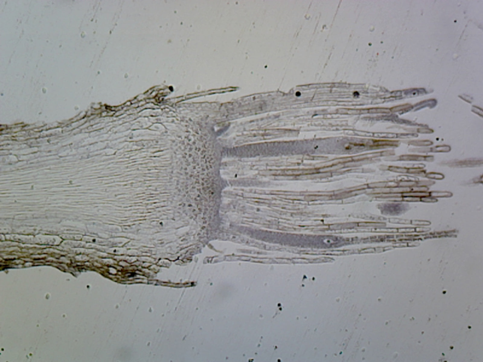 Moss Archegonia; Longitudinal Section